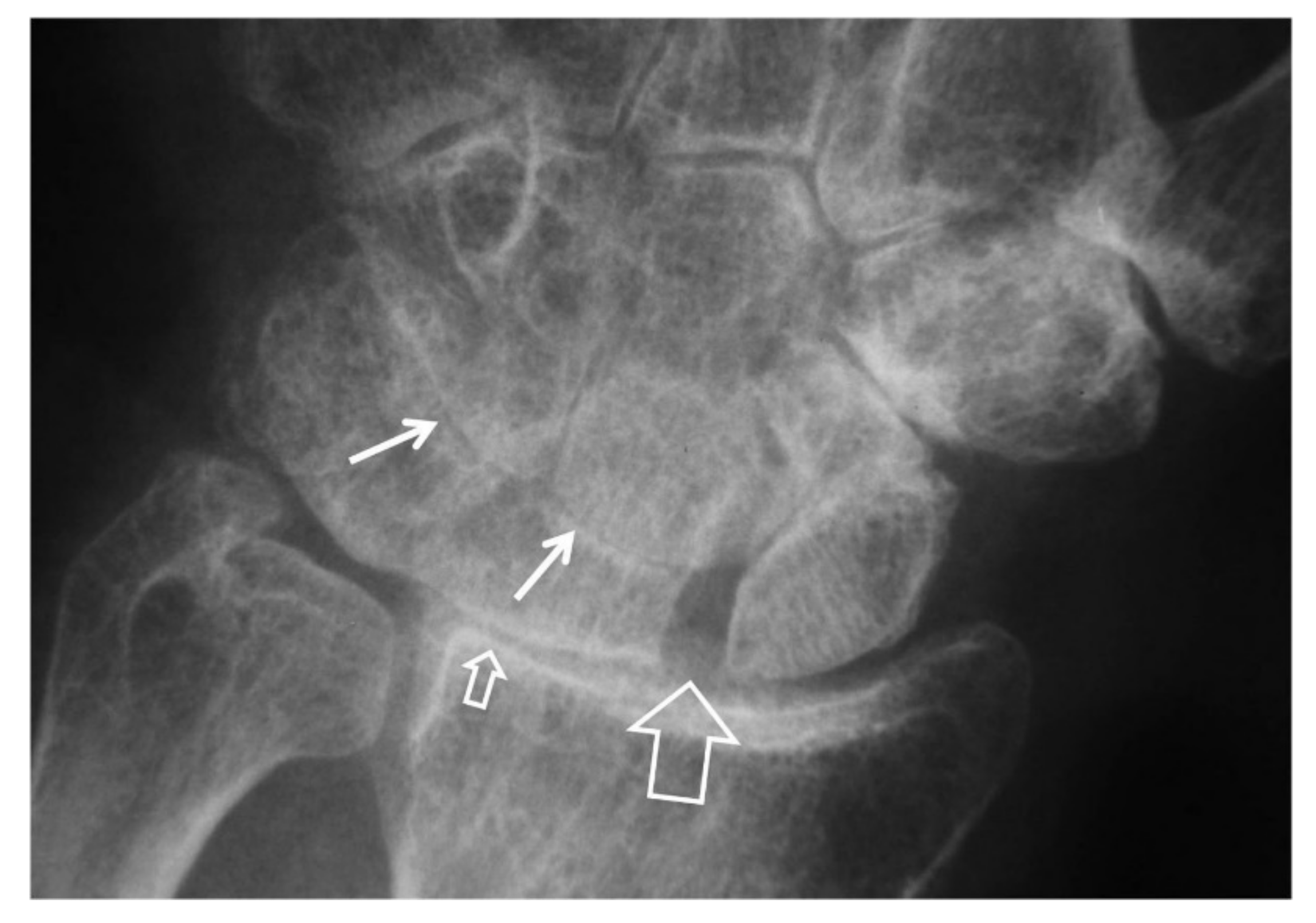 Tomography 07 00042 g004