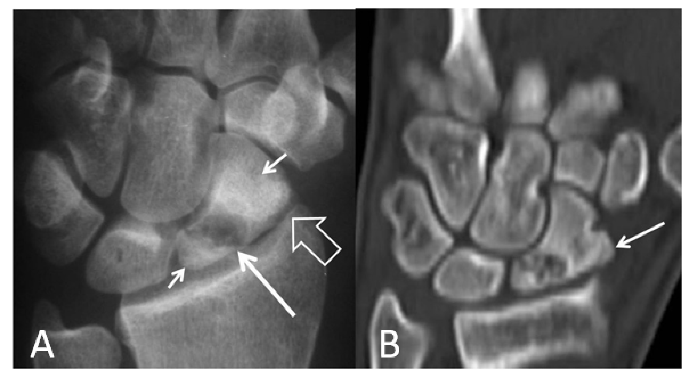 Tomography 07 00042 g005