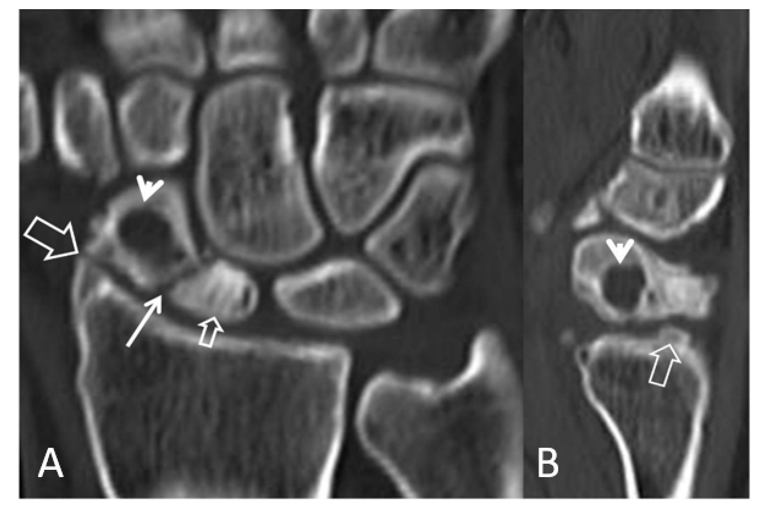 Tomography 07 00042 g006