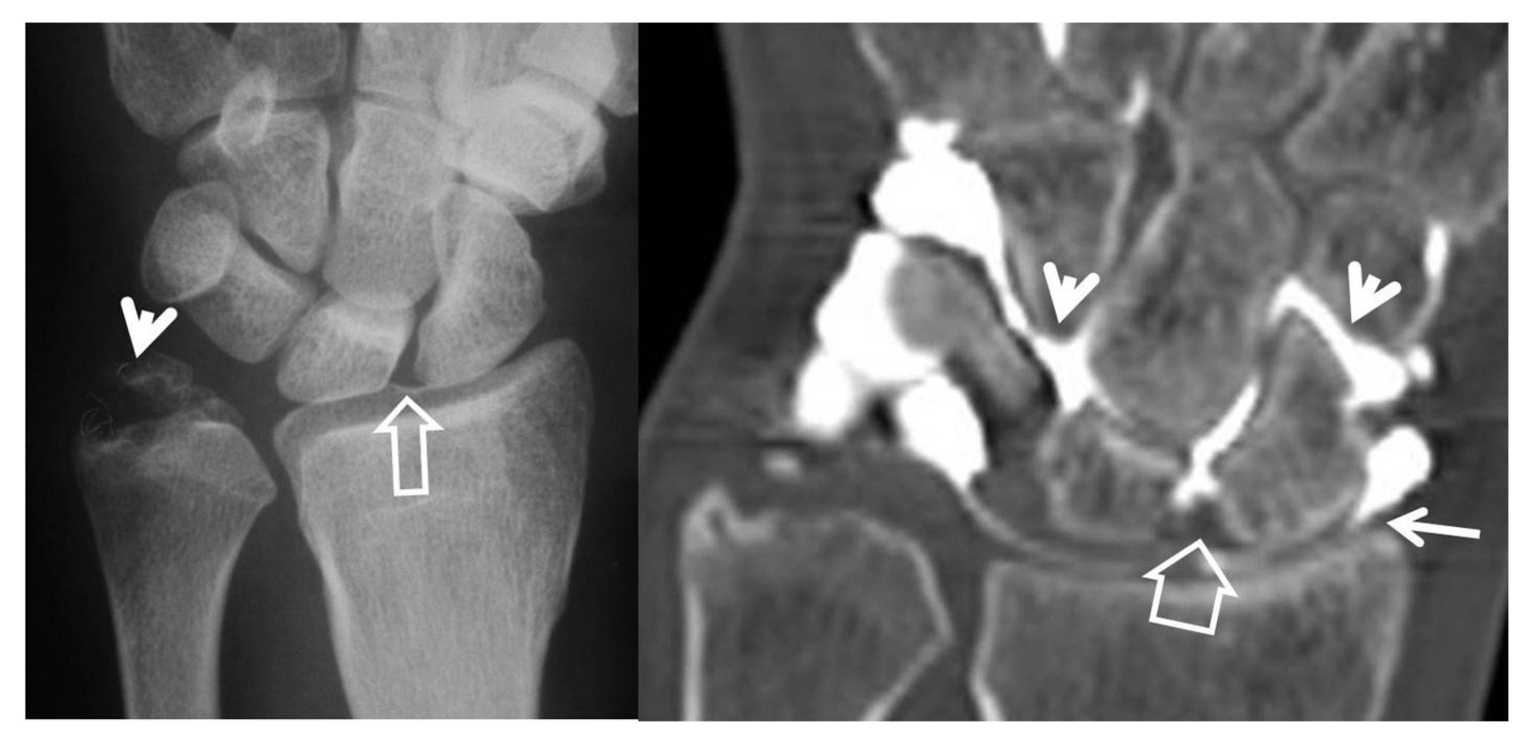 Tomography 07 00042 g007