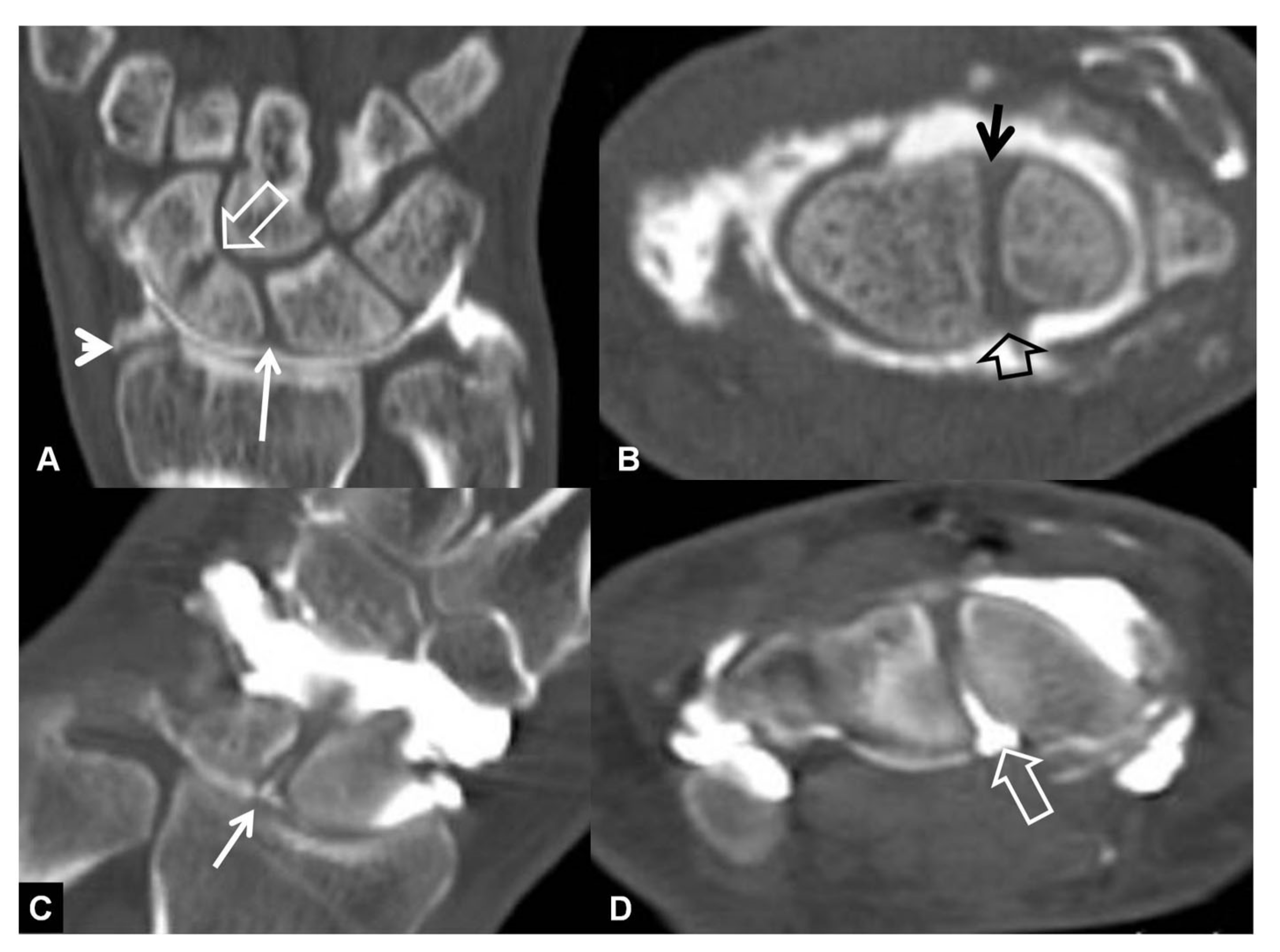 Tomography 07 00042 g008
