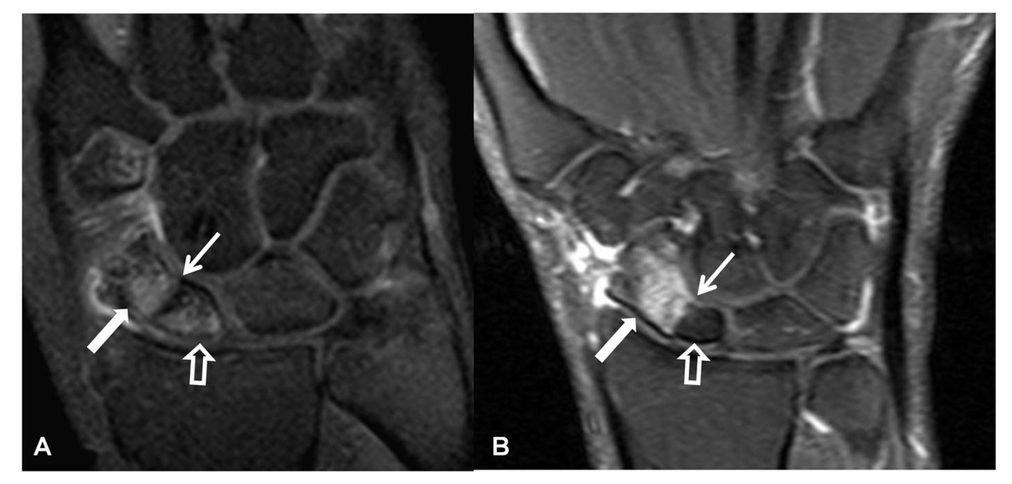 Tomography 07 00042 g011