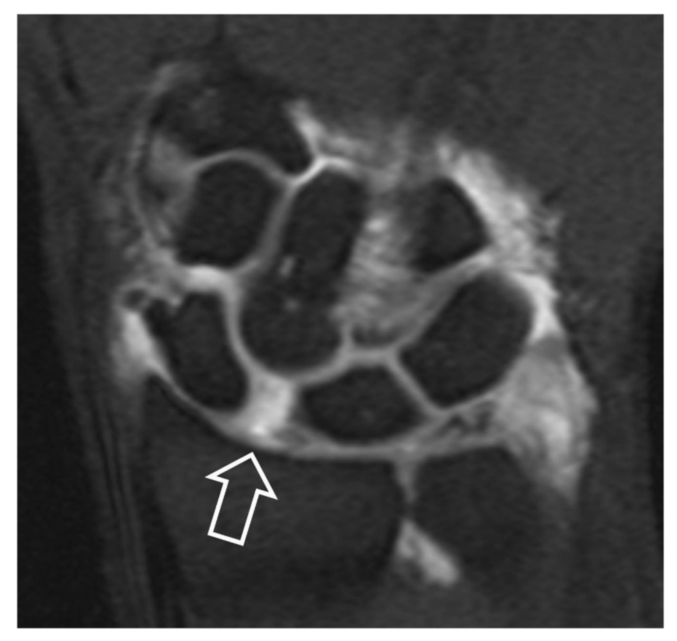 Tomography 07 00042 g012