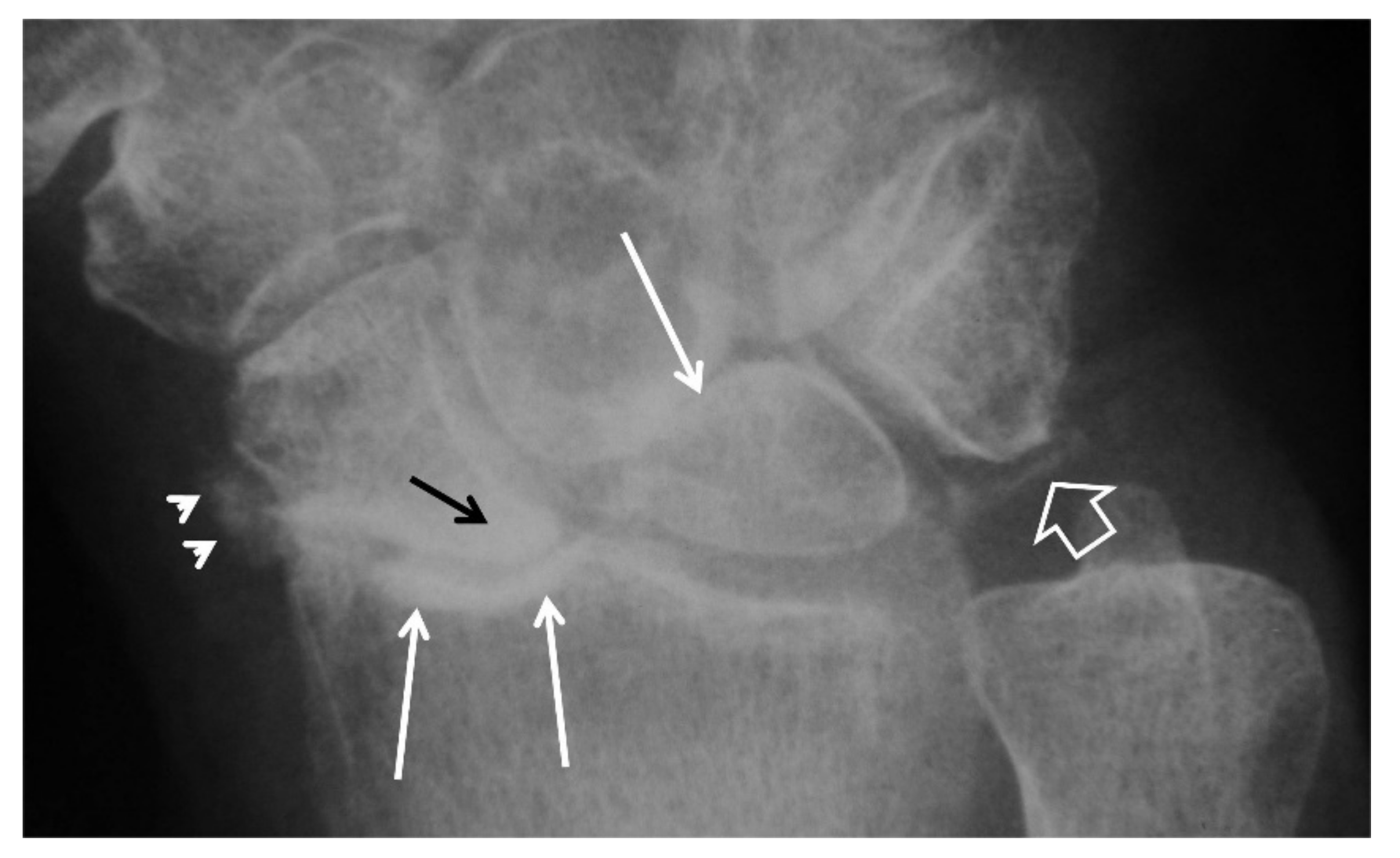 Tomography 07 00042 g015