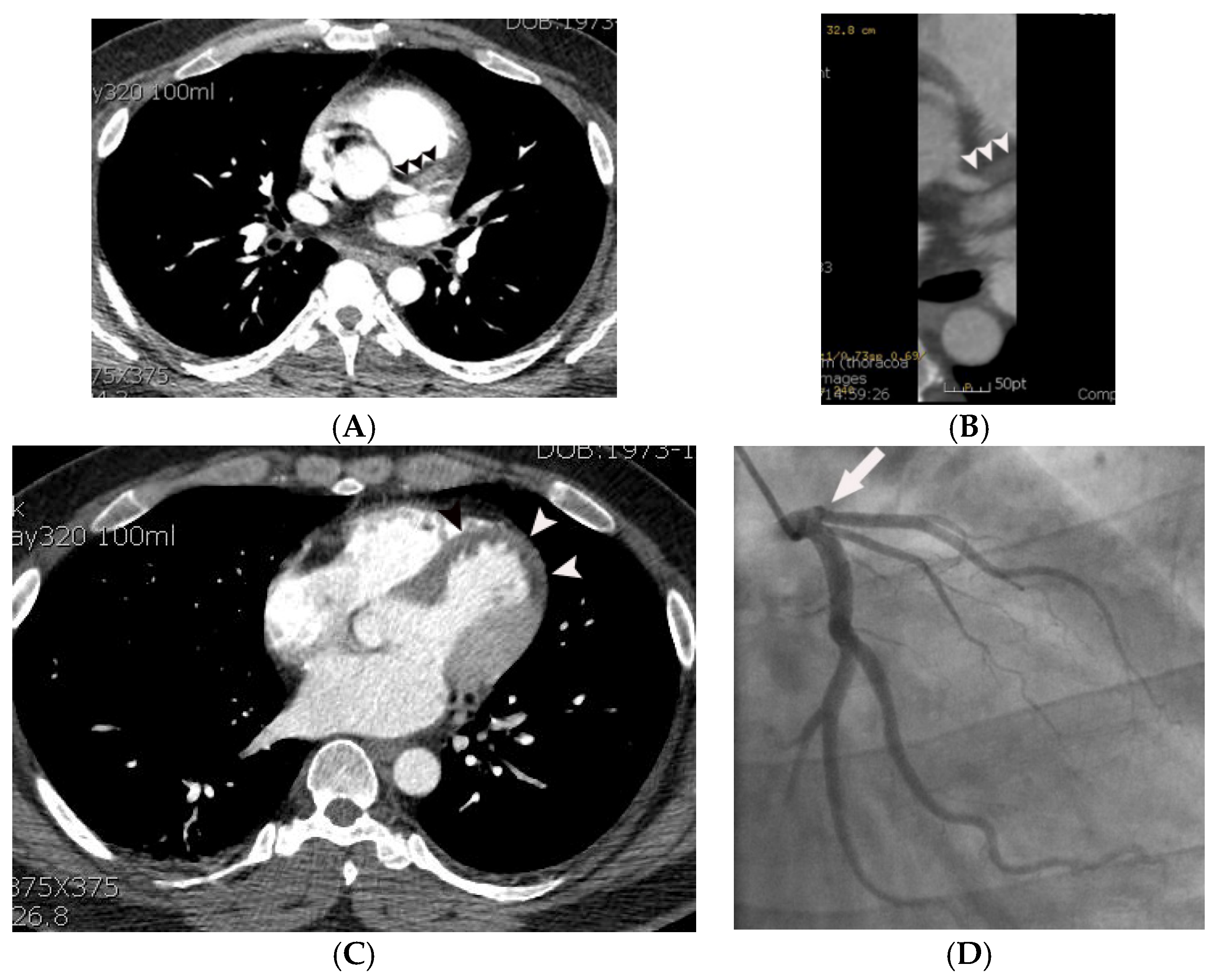 Tomography 07 00043 g003