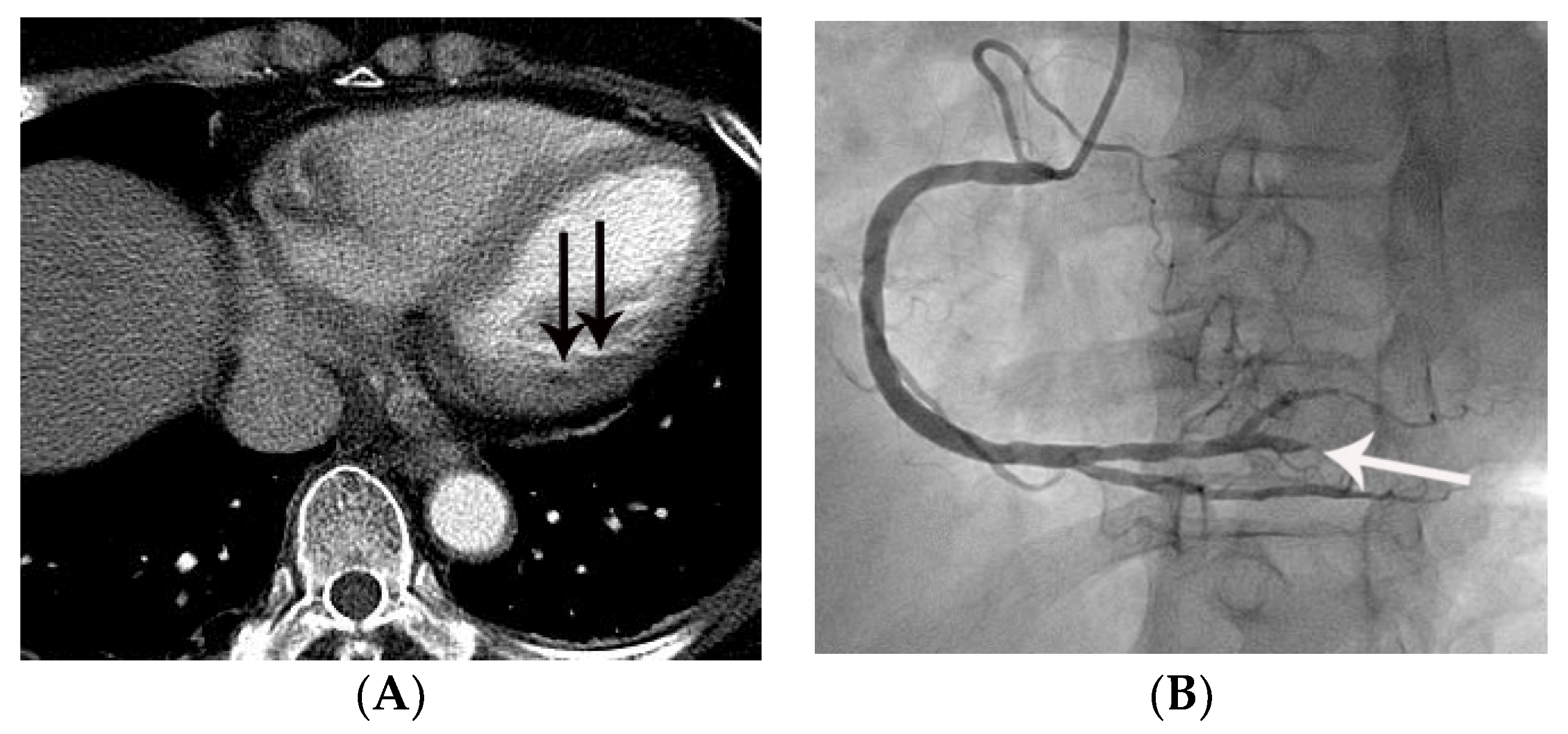Tomography 07 00043 g004