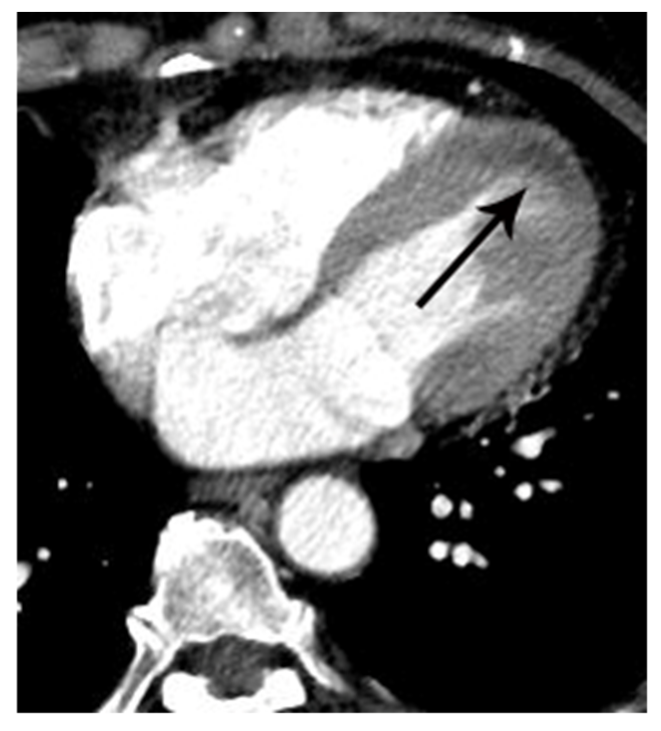 Tomography 07 00043 g005