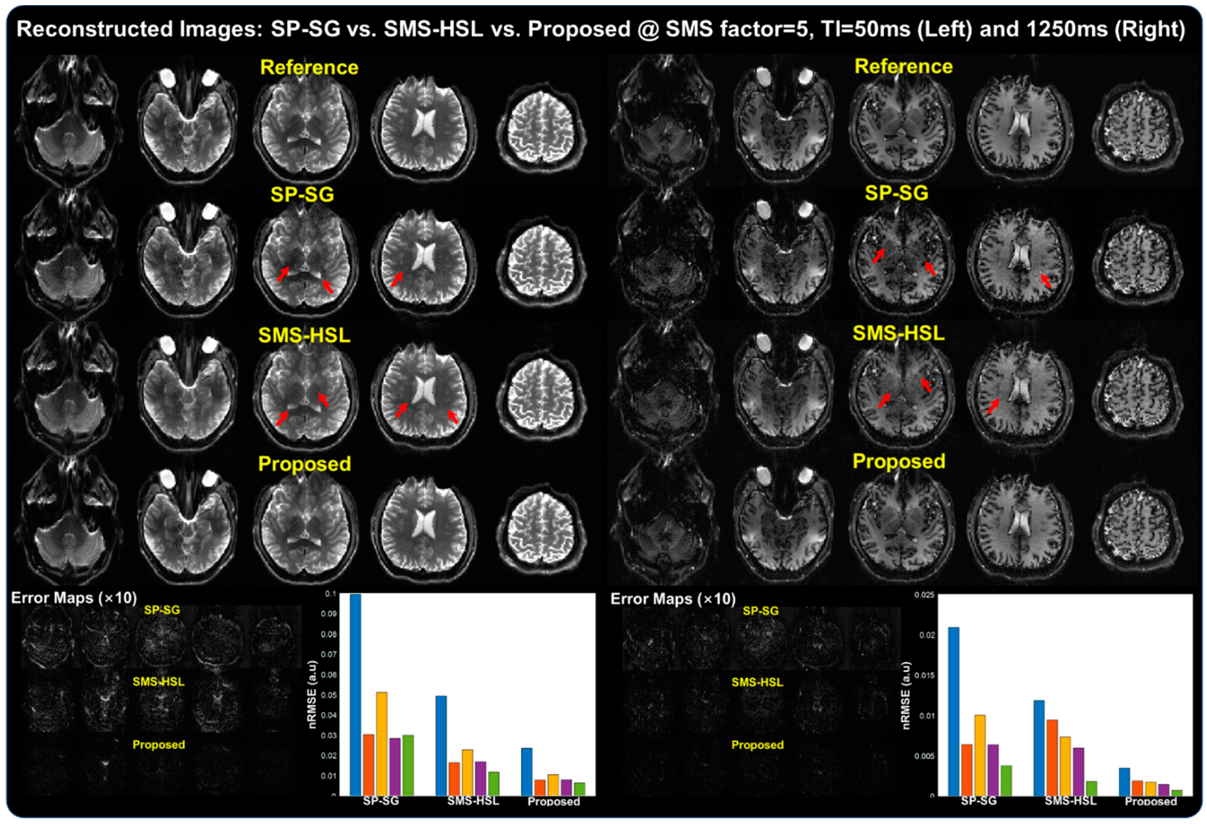 Tomography 07 00047 g003