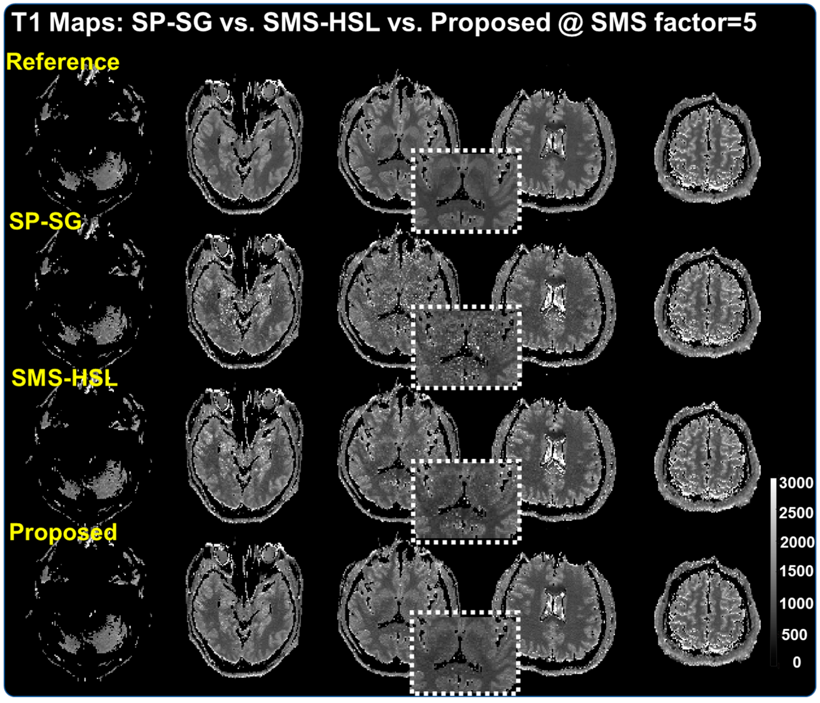 Tomography 07 00047 g004