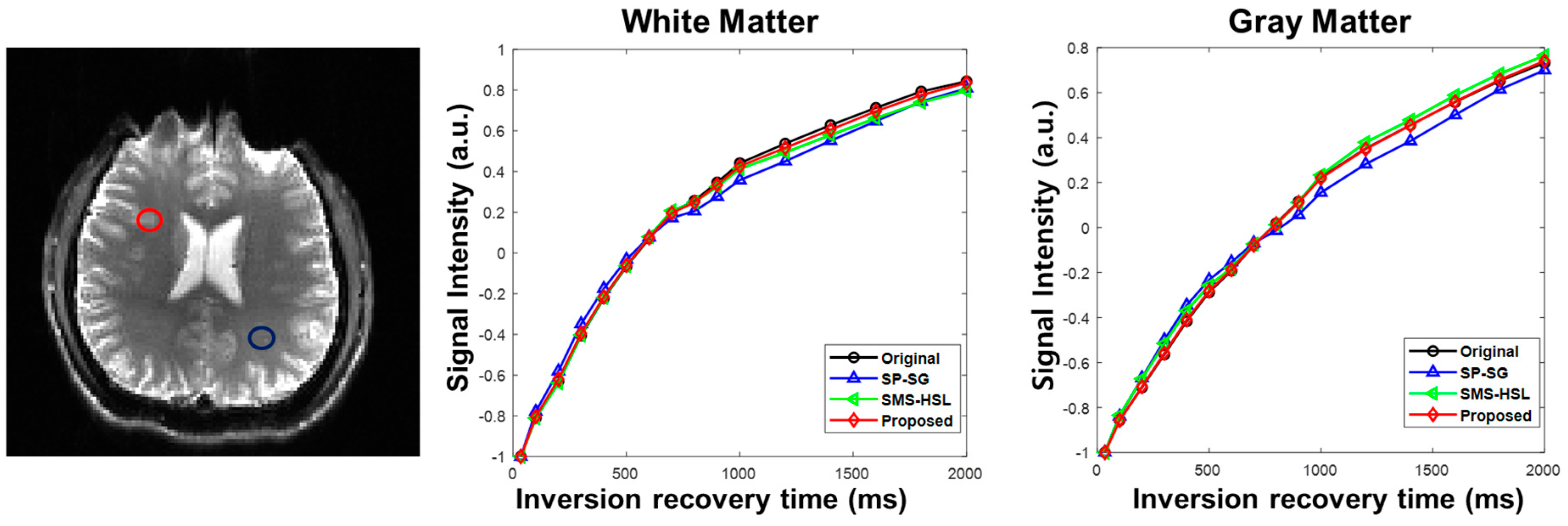 Tomography 07 00047 g005