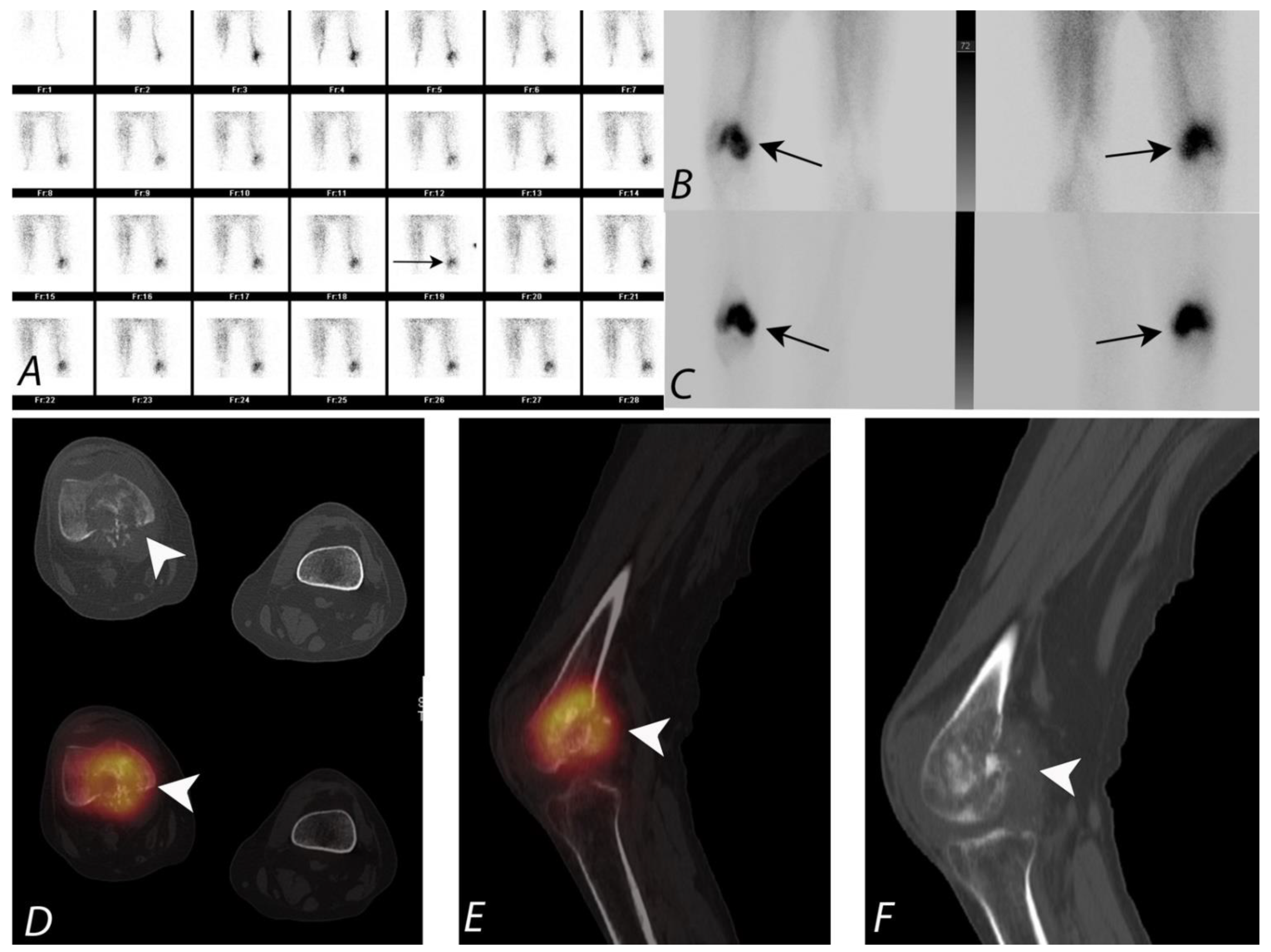 Tomography 07 00050 g005 Tomography 07 00050 g005