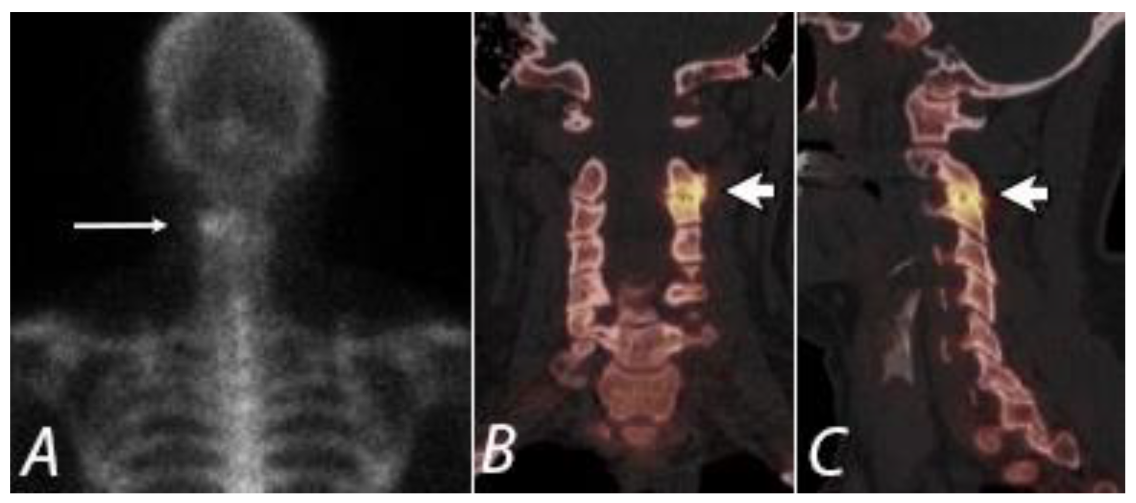 Tomography 07 00050 g007 Tomography 07 00050 g007