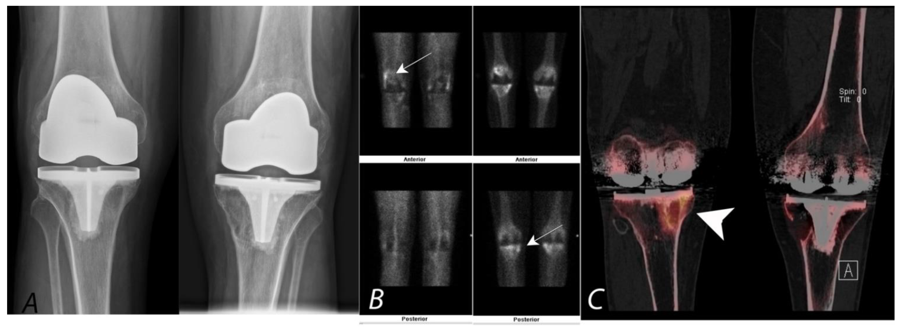 Tomography 07 00050 g008 Tomography 07 00050 g008