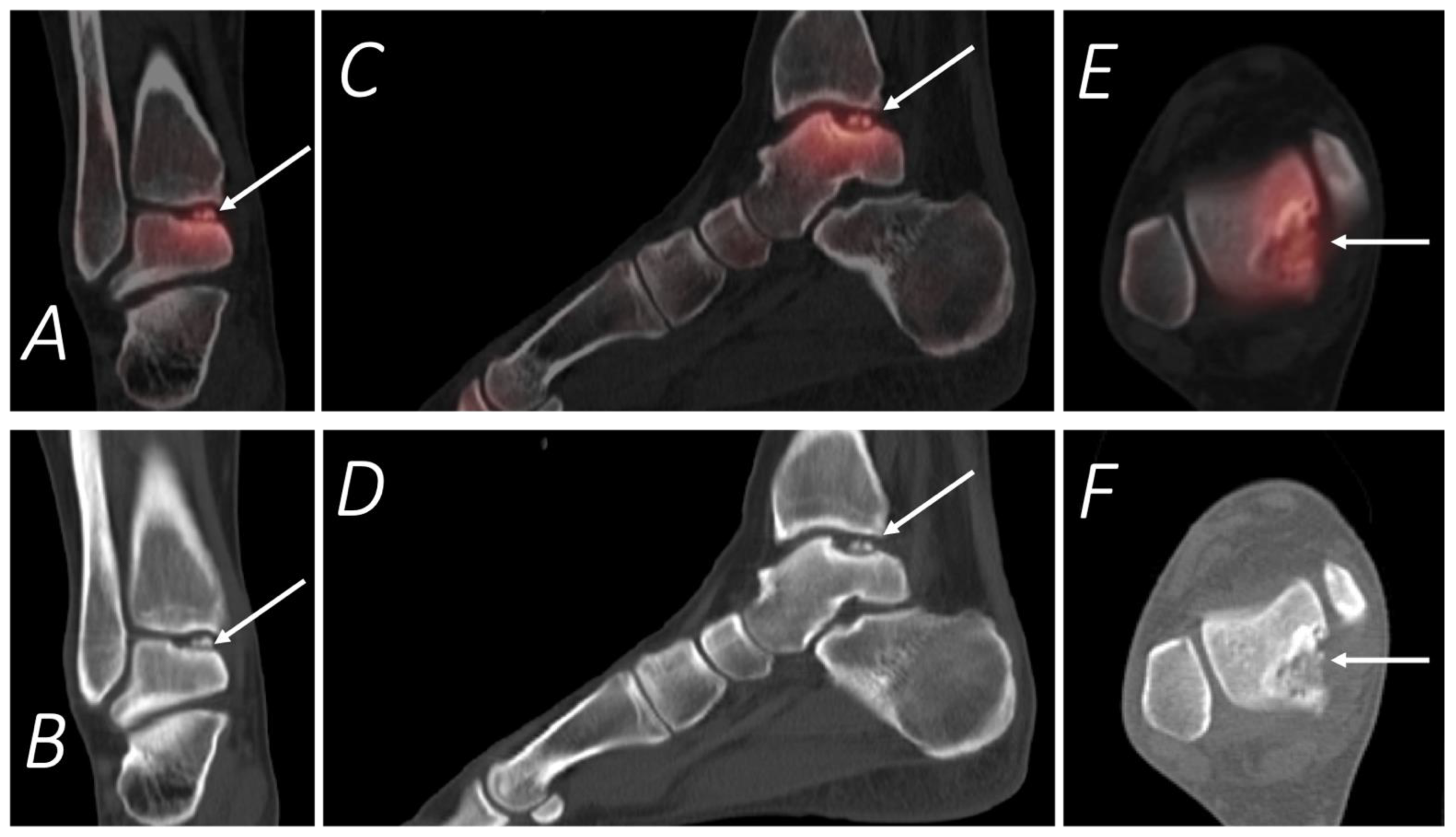 Tomography 07 00050 g010 Tomography 07 00050 g010