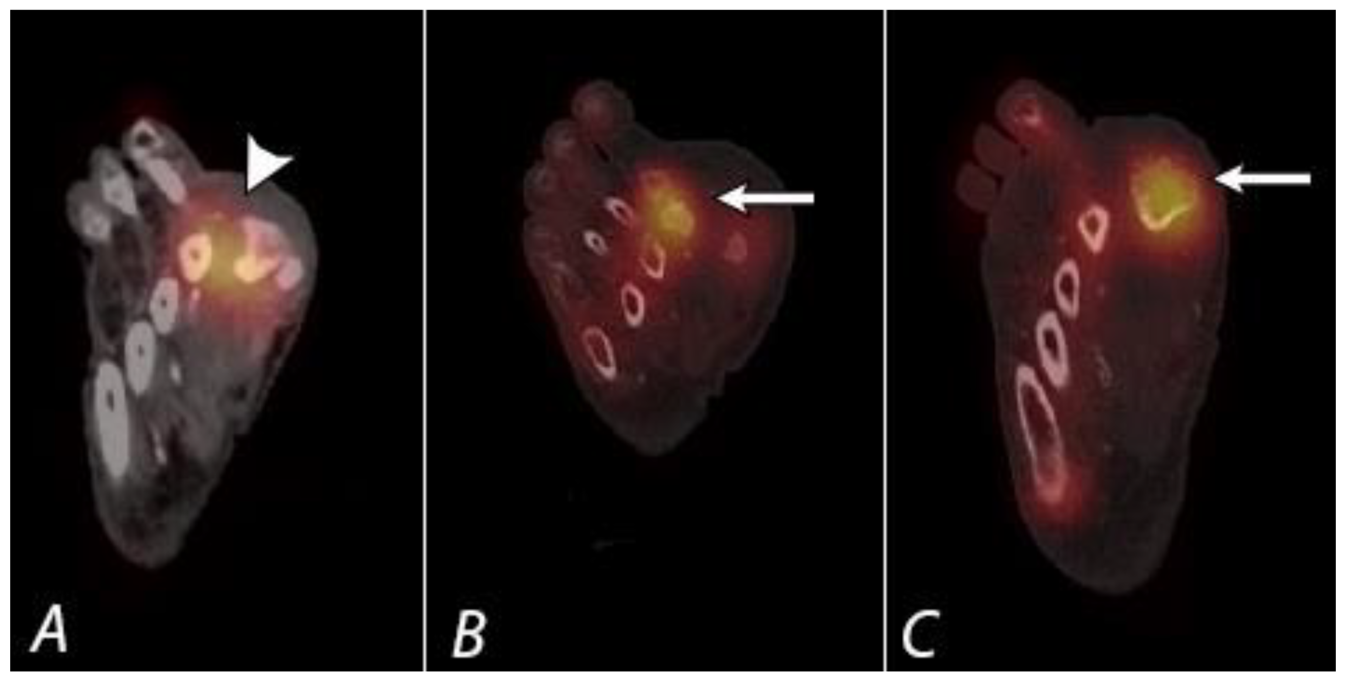 Tomography 07 00050 g012 Tomography 07 00050 g012