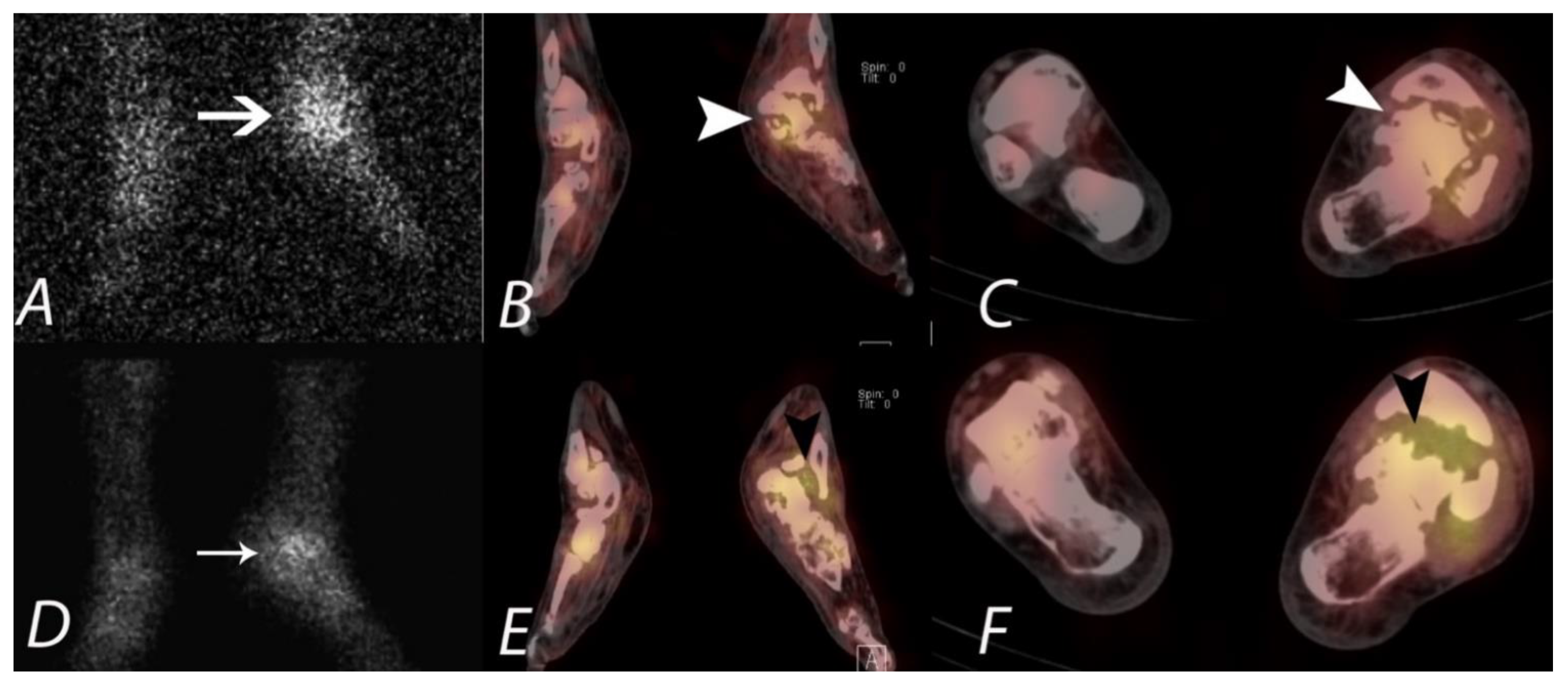 Tomography 07 00050 g014 Tomography 07 00050 g014