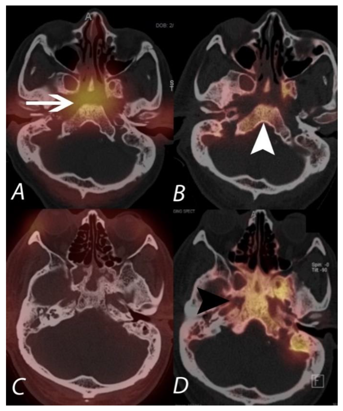 Tomography 07 00050 g015 Tomography 07 00050 g015