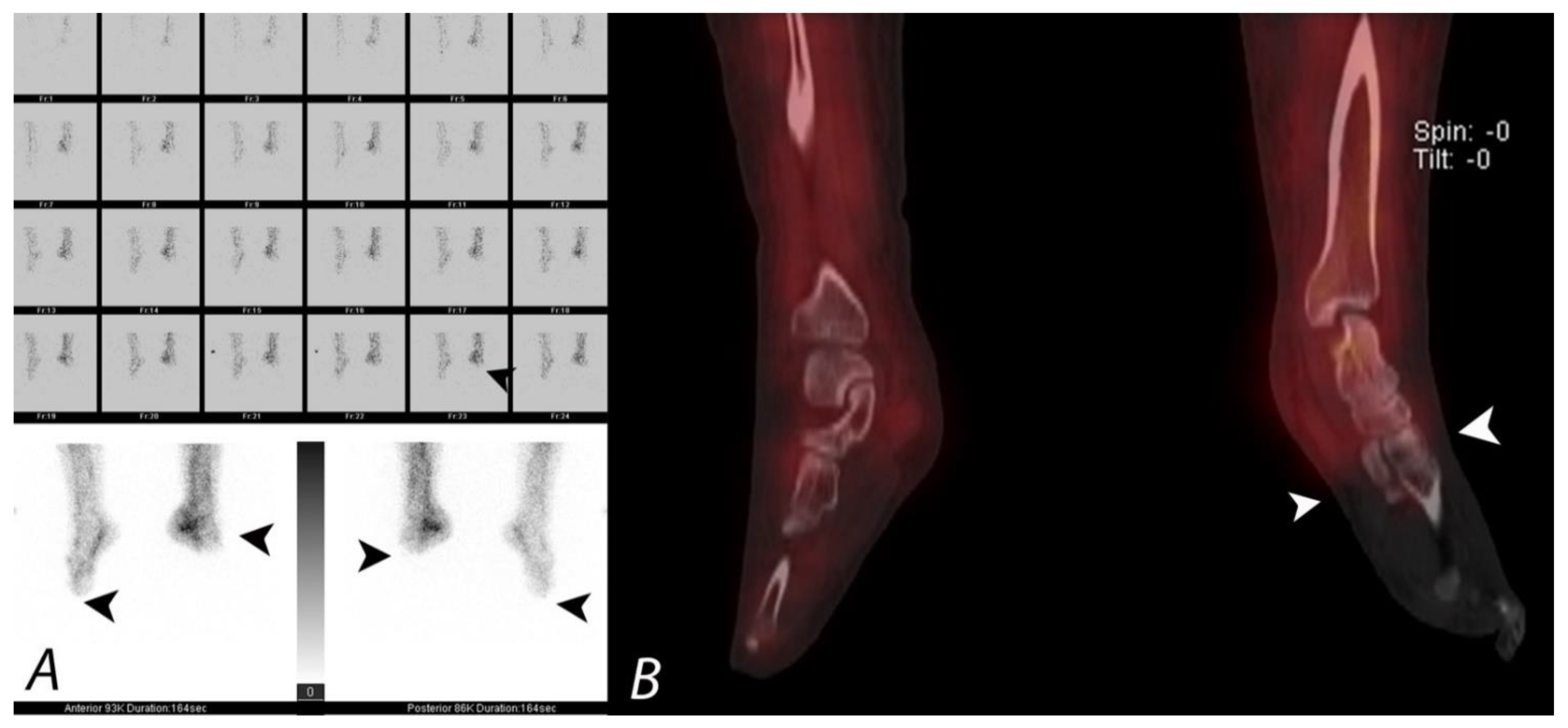 Tomography 07 00050 g017 Tomography 07 00050 g017