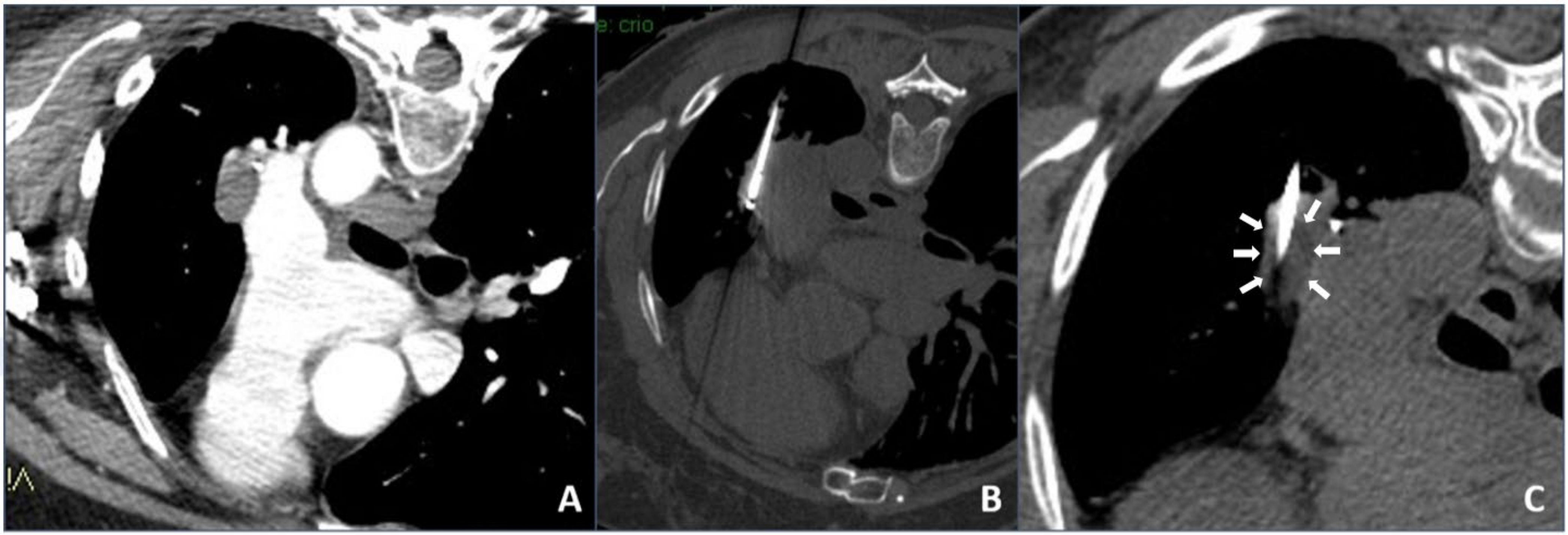 Tomography 07 00057 g002