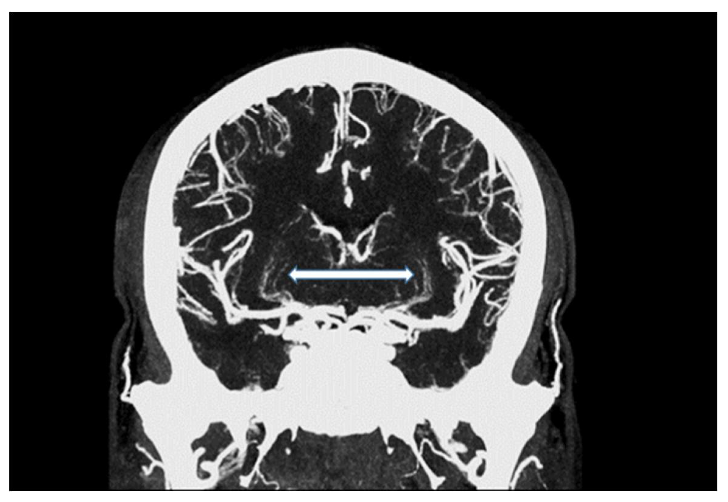 Tomography 07 00059 g002