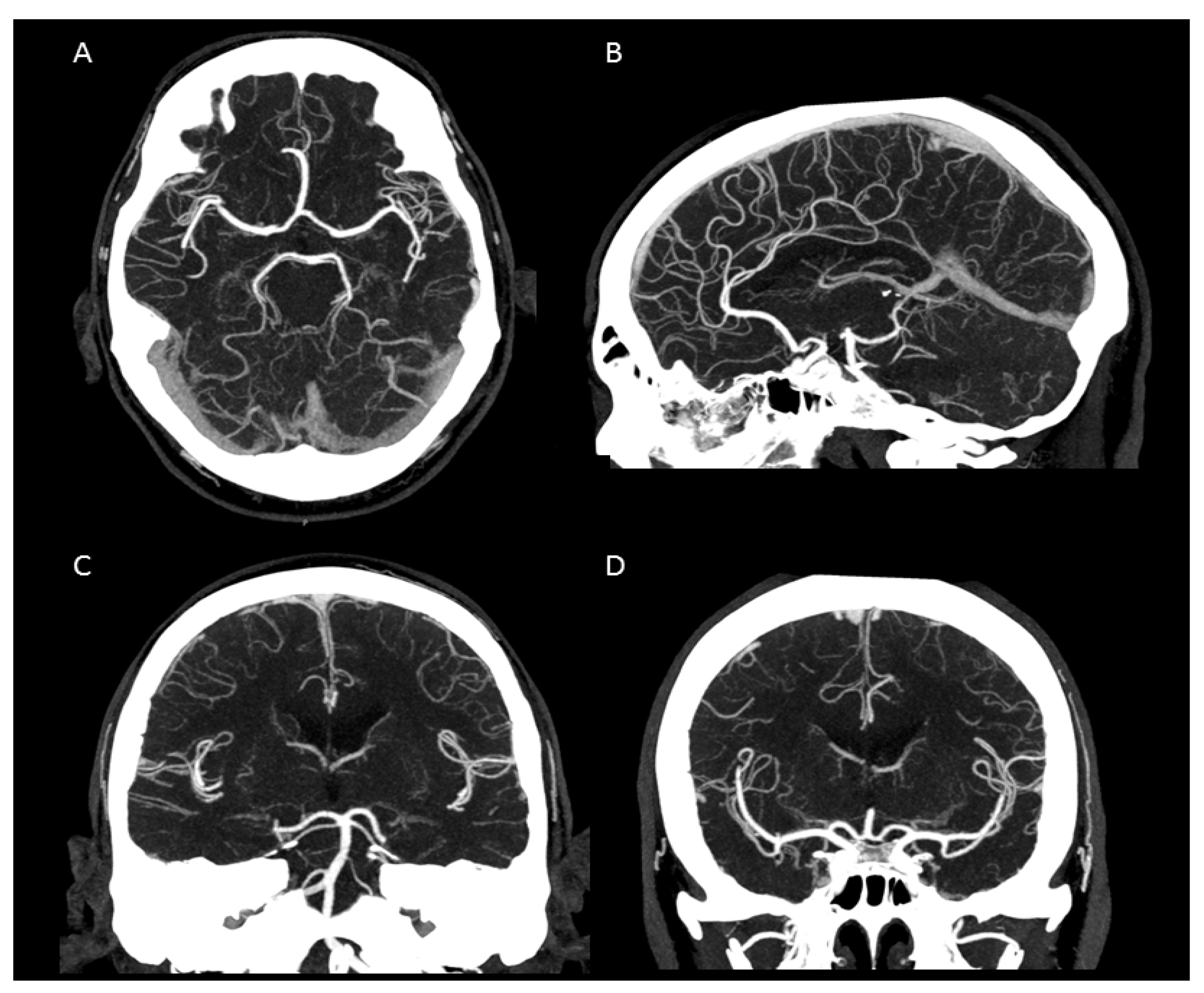 Tomography 07 00059 g003