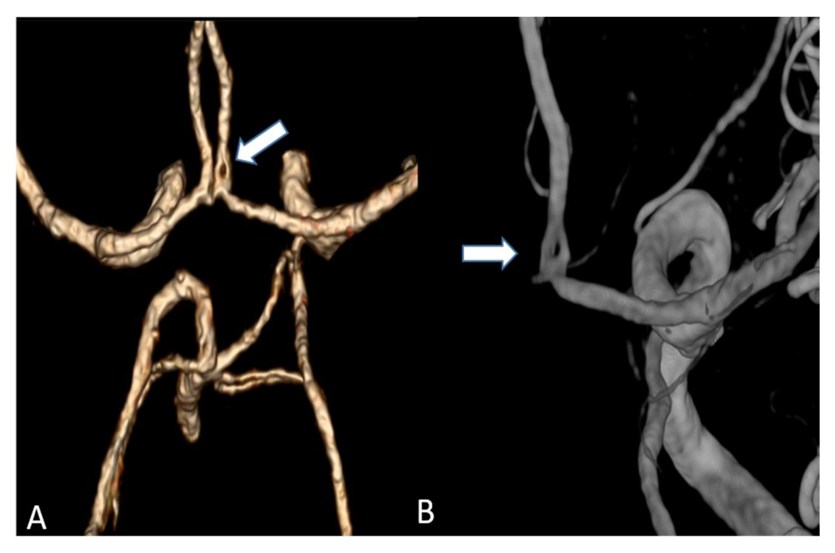 Tomography 07 00059 g005