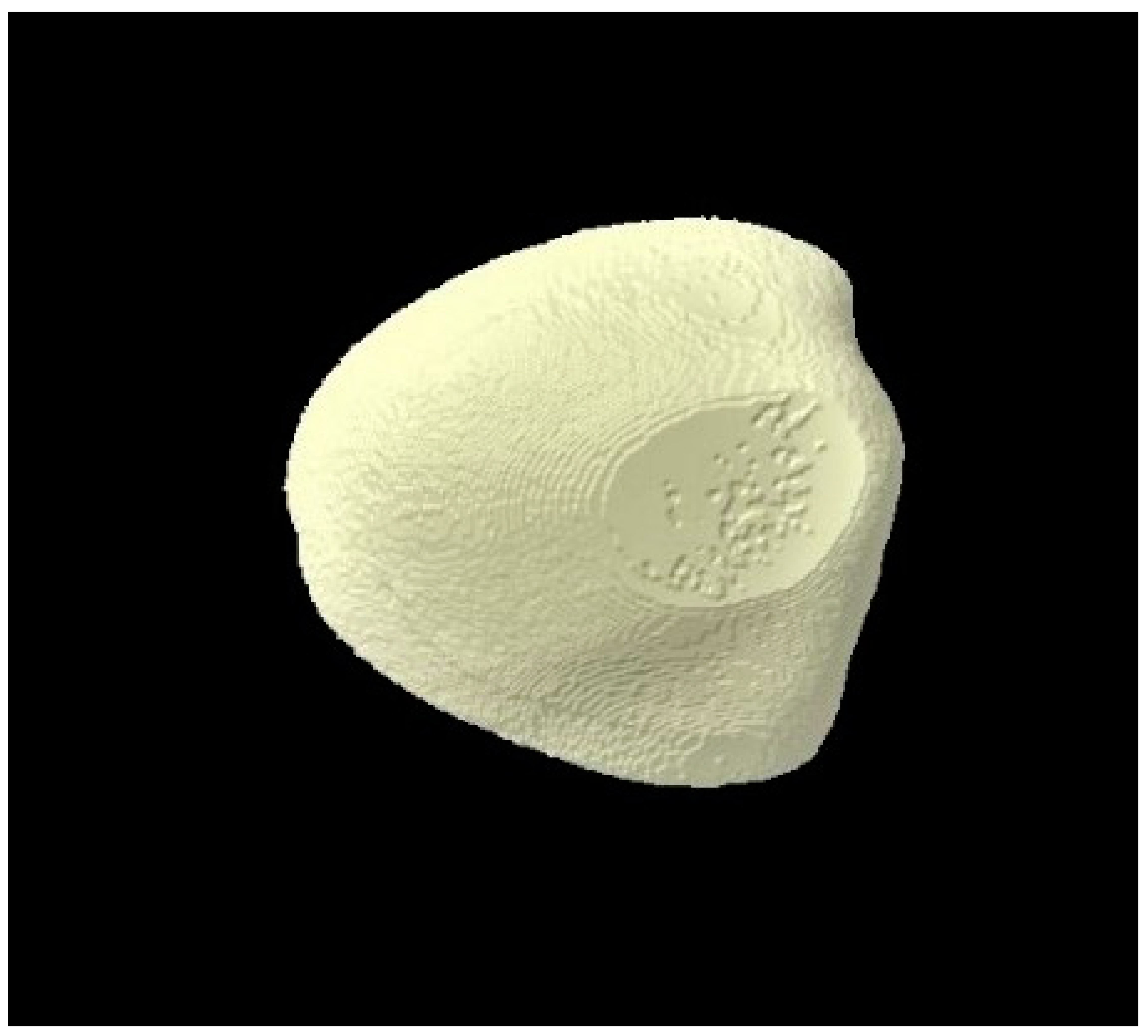 Tomography 07 00063 g005 Tomography 07 00063 g005