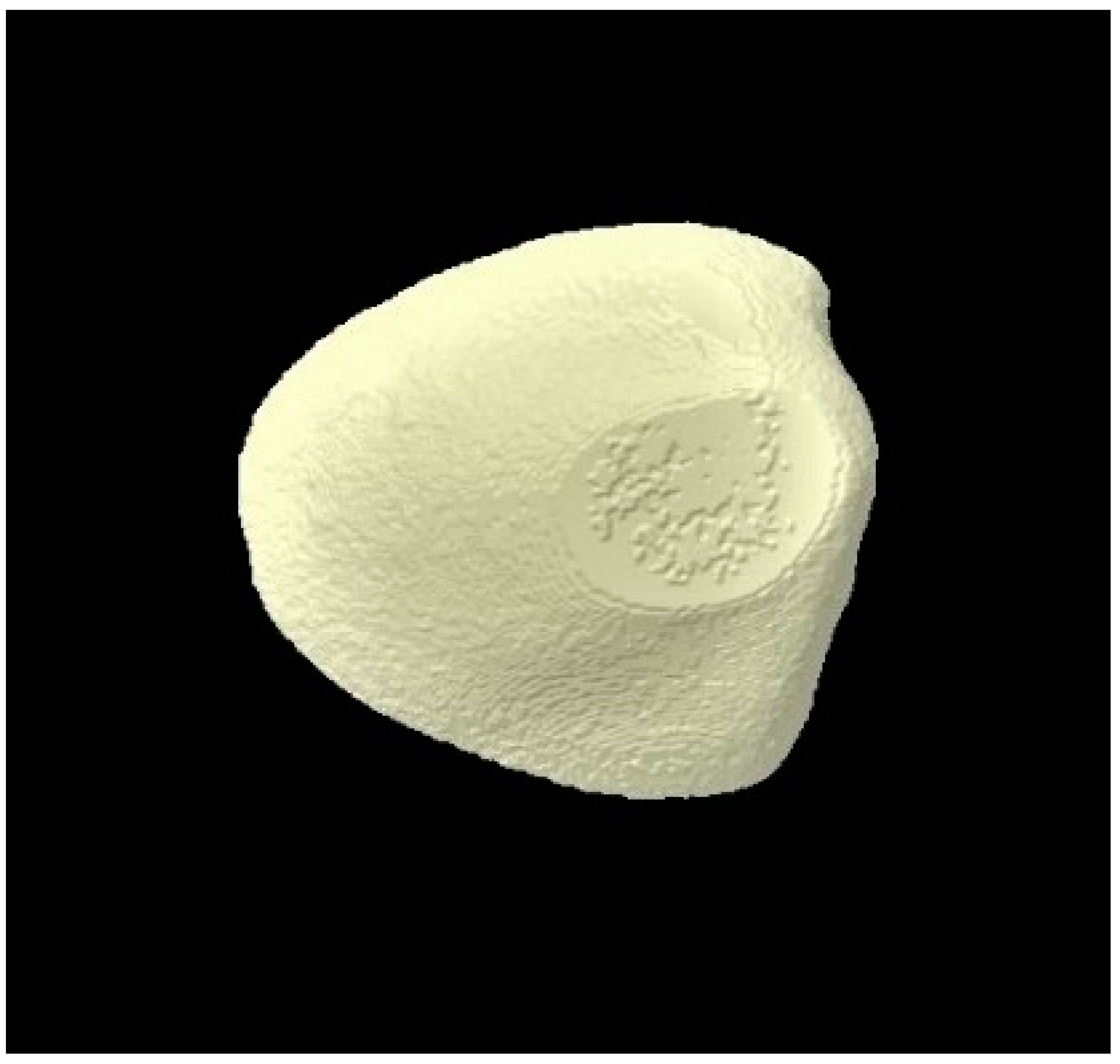 Tomography 07 00063 g006 Tomography 07 00063 g006