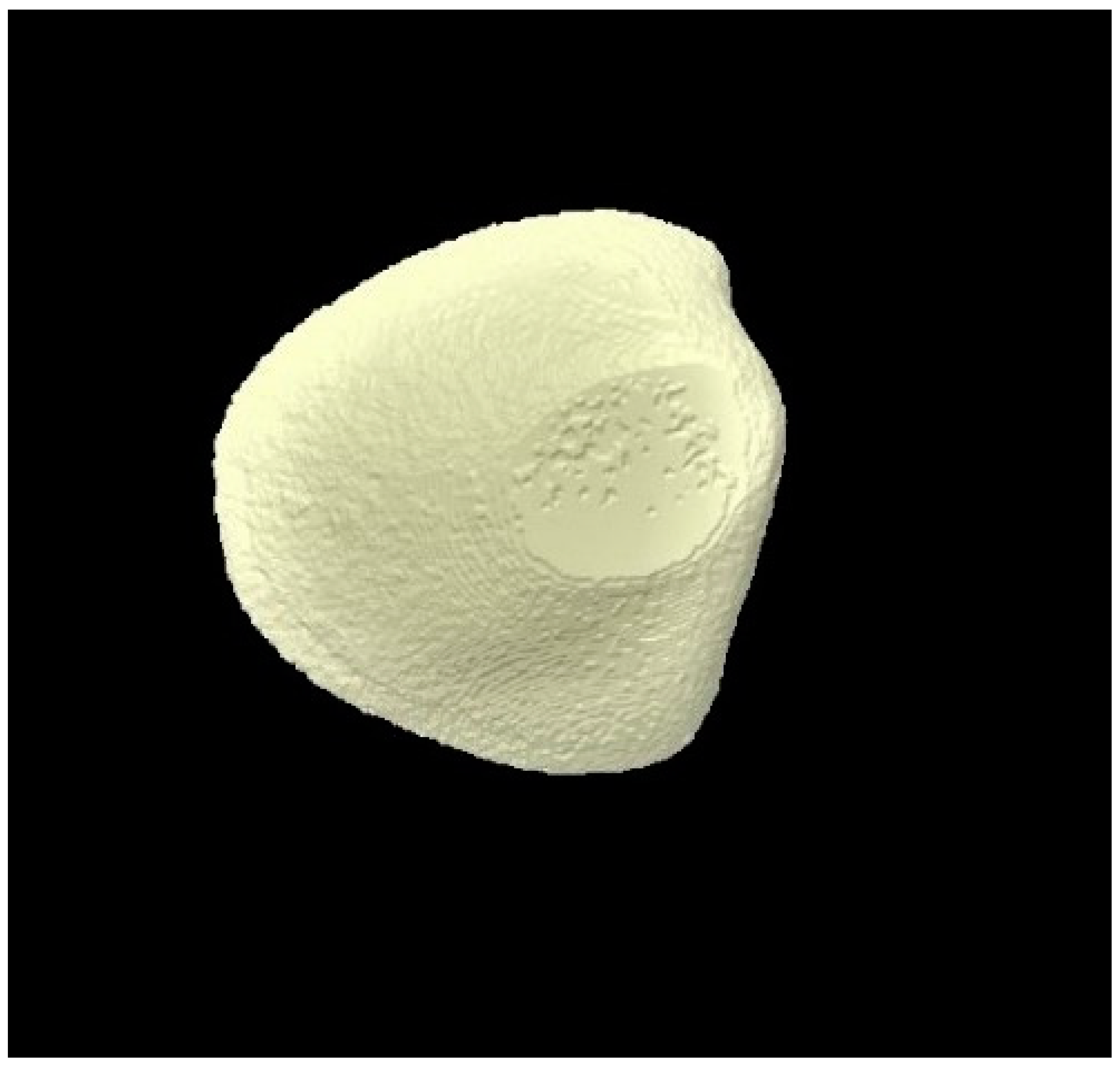 Tomography 07 00063 g007 Tomography 07 00063 g007