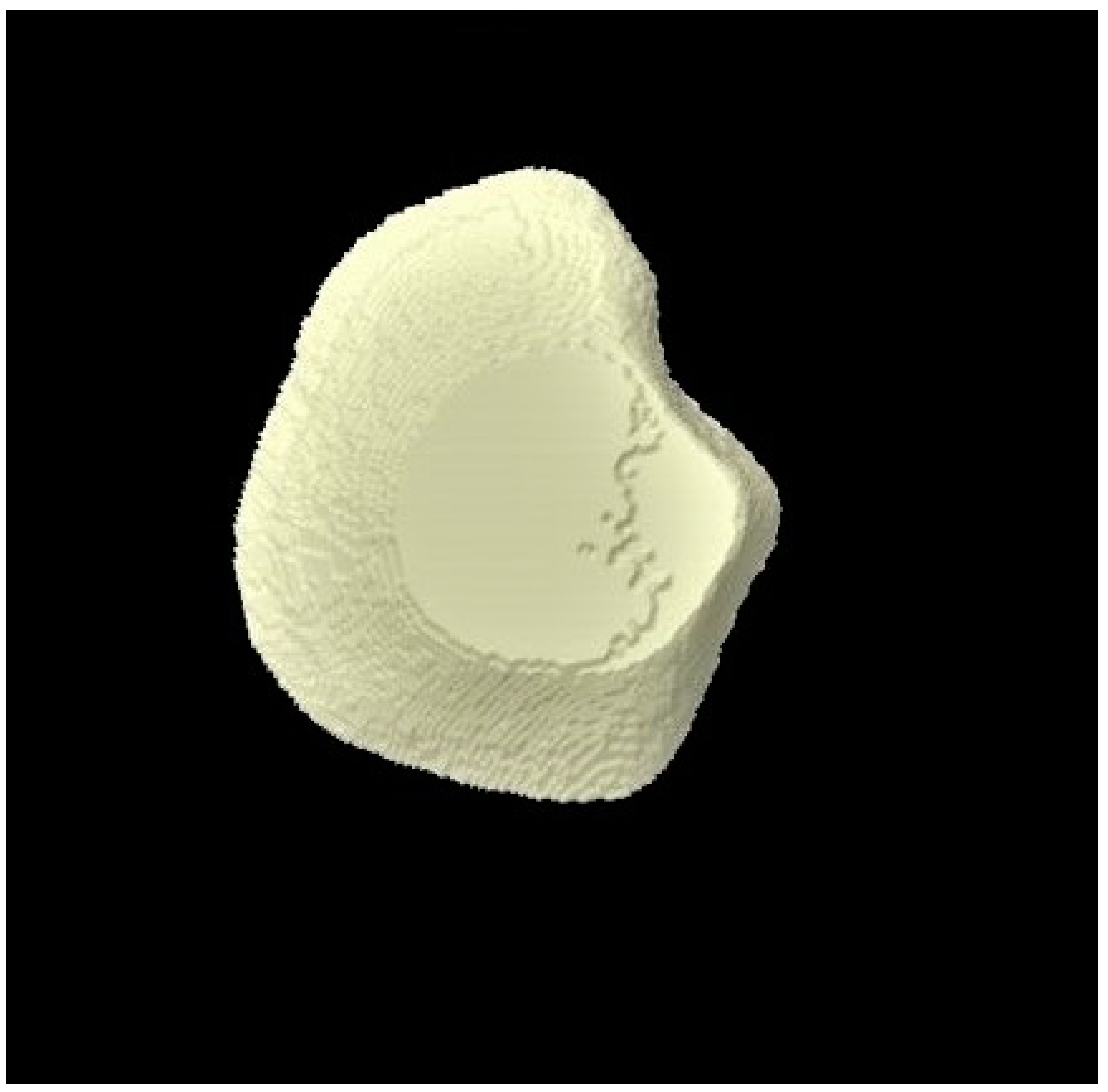 Tomography 07 00063 g008 Tomography 07 00063 g008