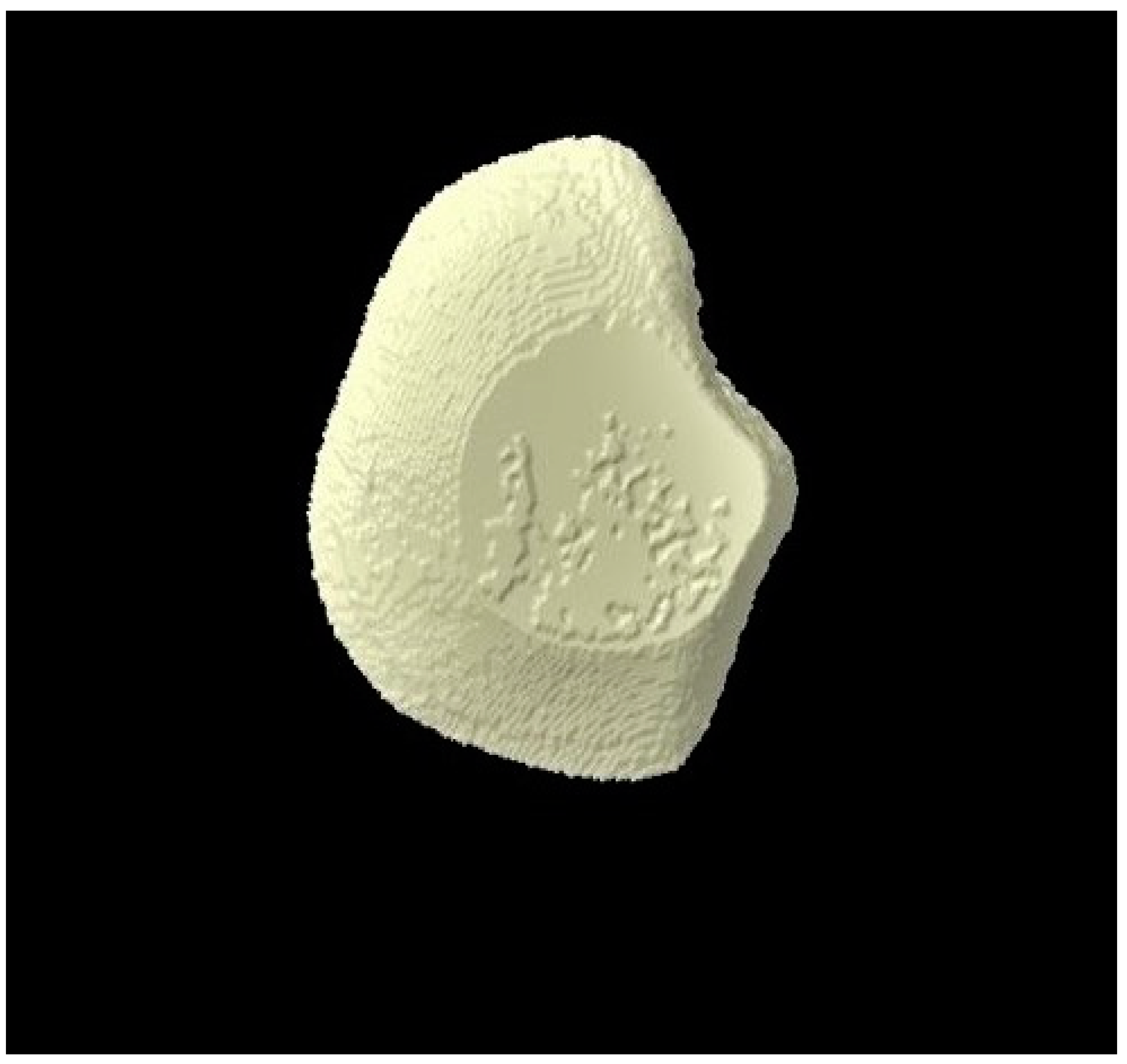 Tomography 07 00063 g009 Tomography 07 00063 g009