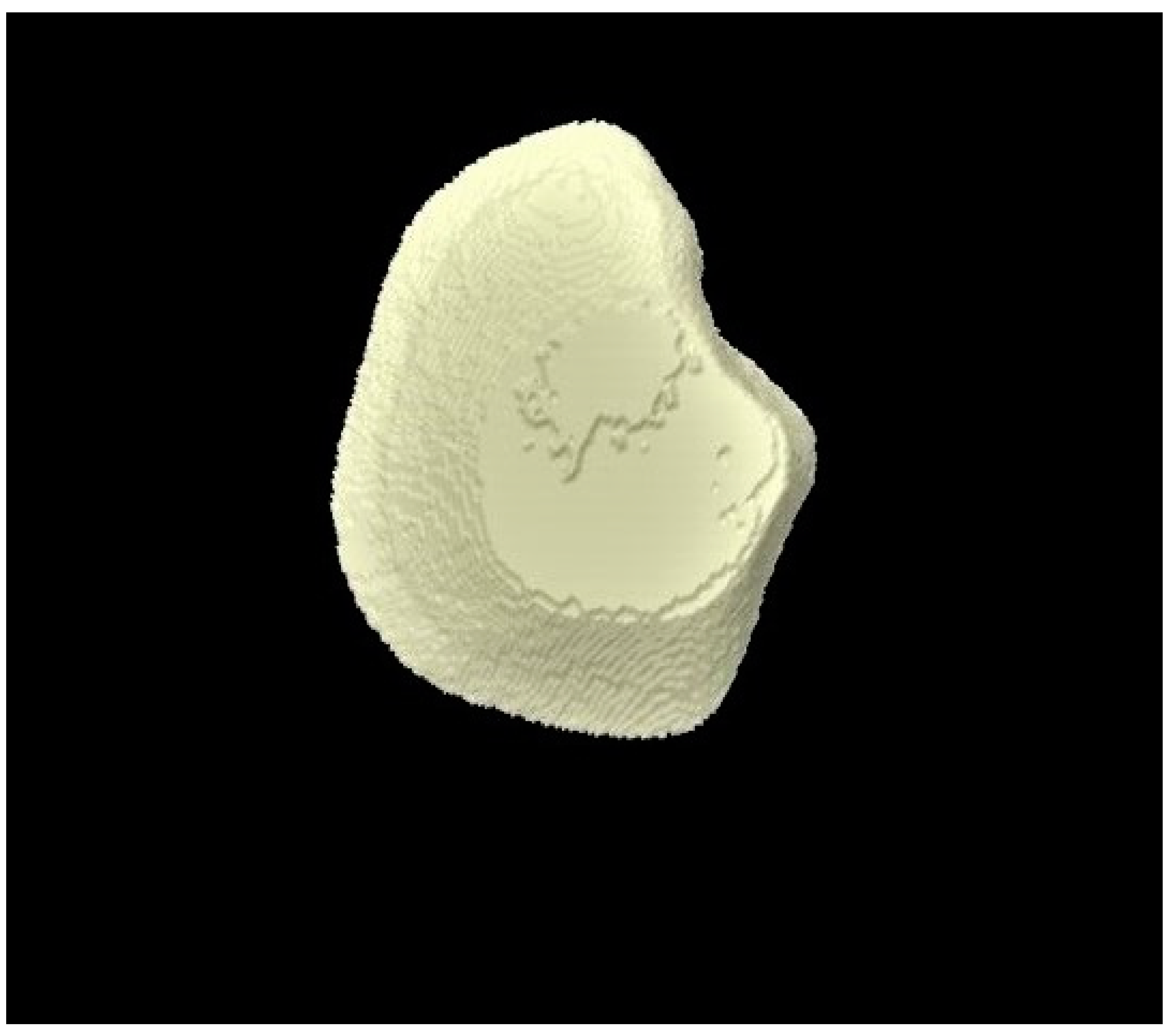 Tomography 07 00063 g010 Tomography 07 00063 g010