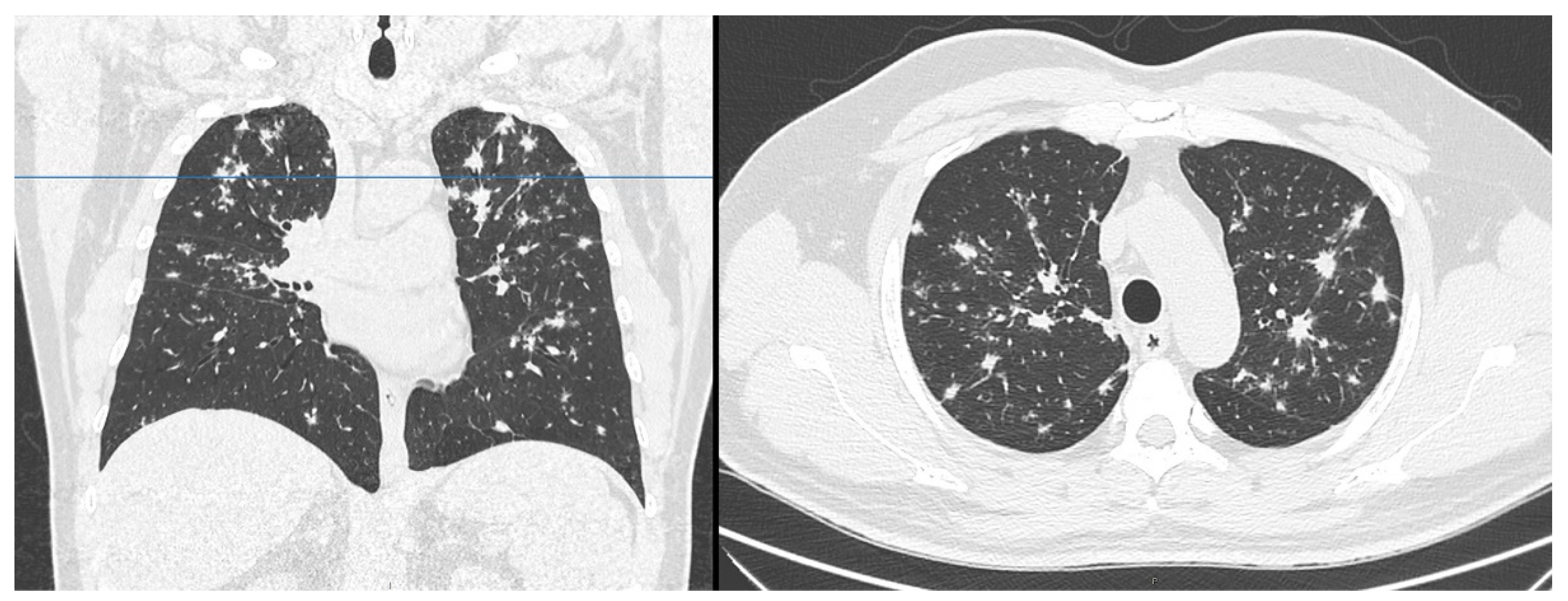 Tomography 07 00065 g001 Tomography 07 00065 g001