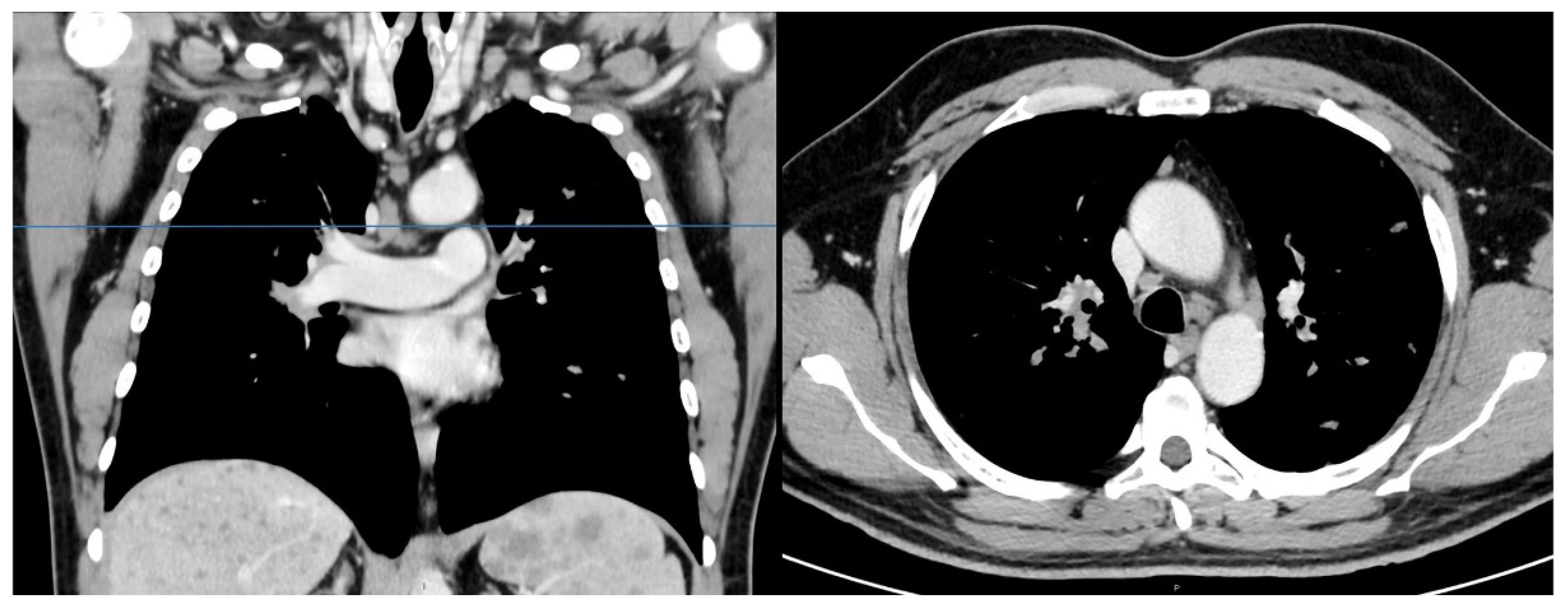 Tomography 07 00065 g002 Tomography 07 00065 g002