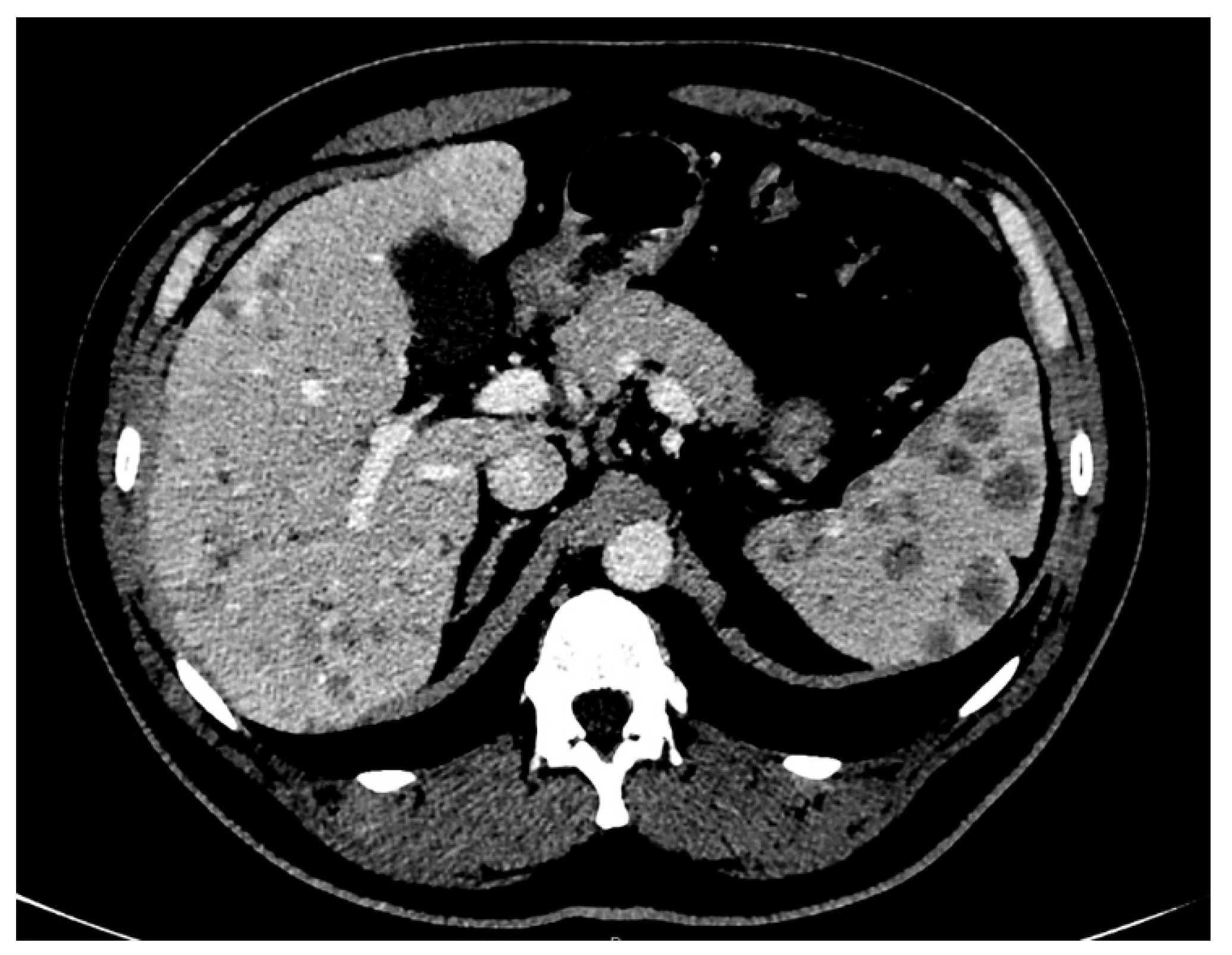 Tomography 07 00065 g003 Tomography 07 00065 g003