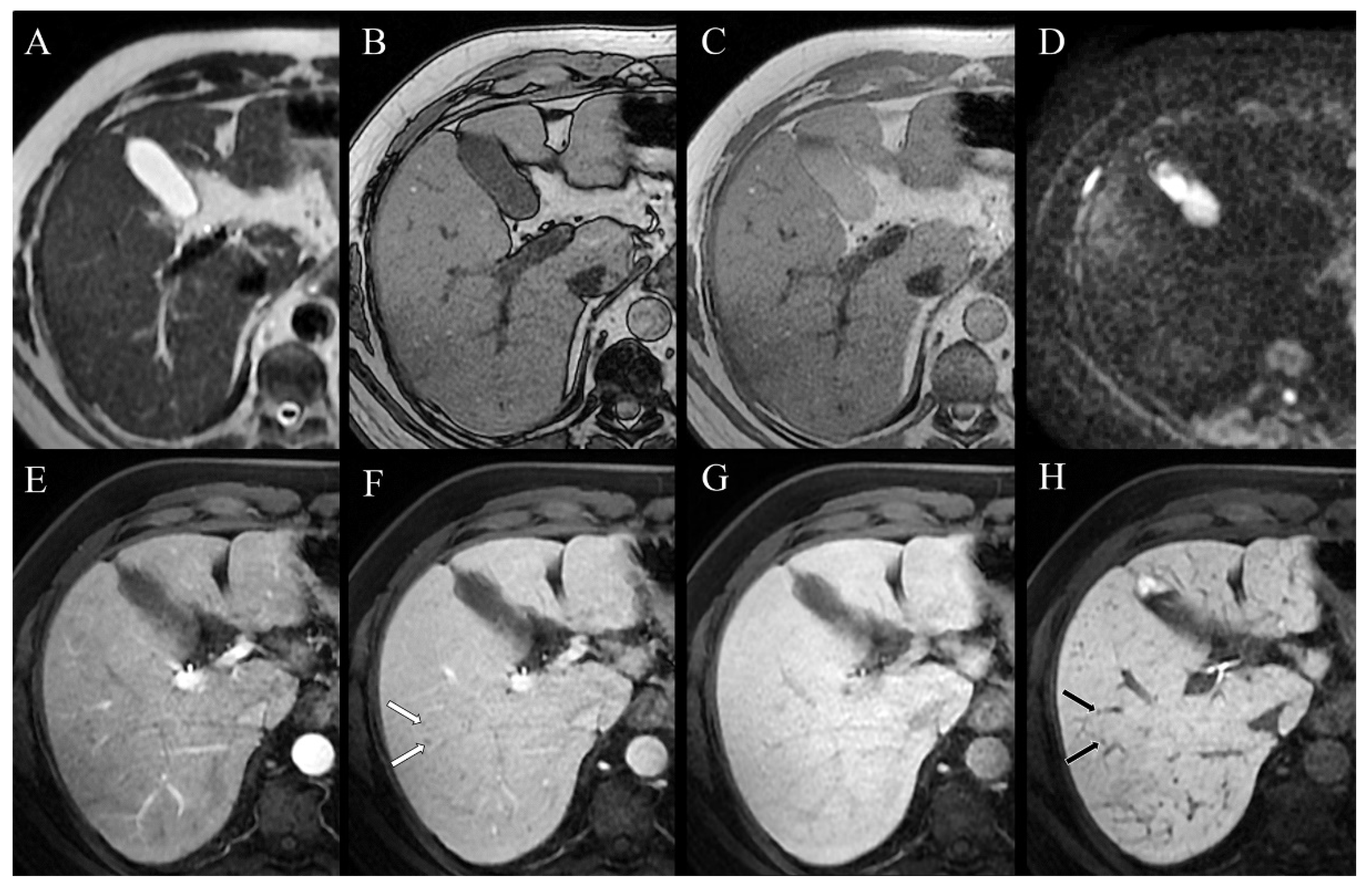 Tomography 07 00065 g004 Tomography 07 00065 g004