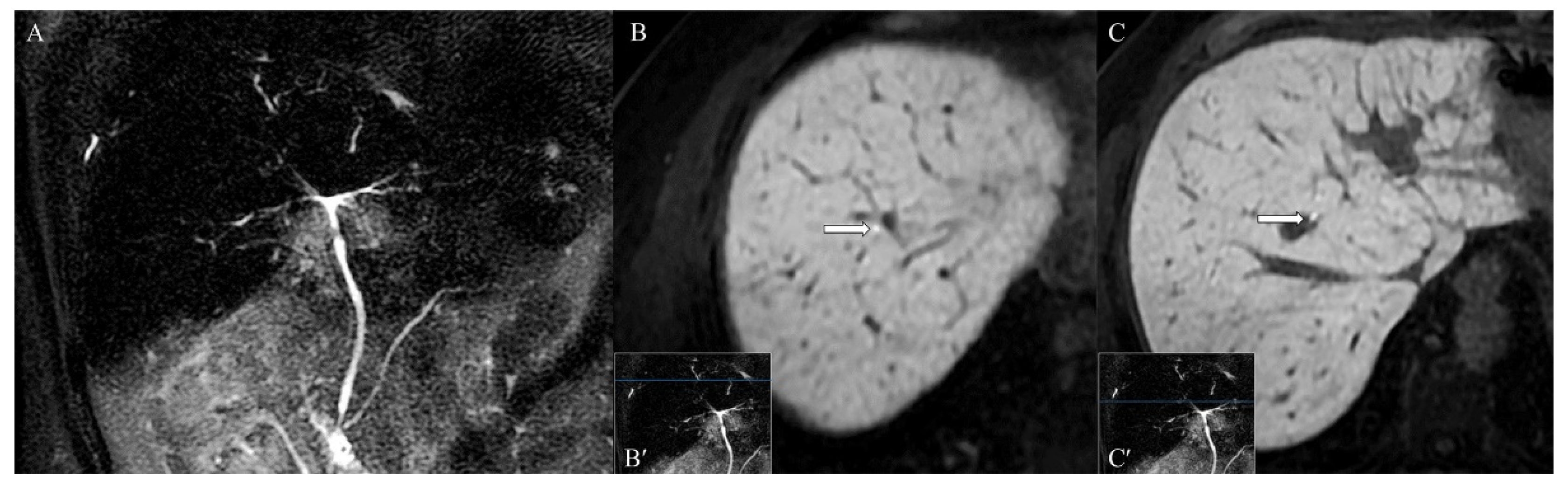 Tomography 07 00065 g005 Tomography 07 00065 g005