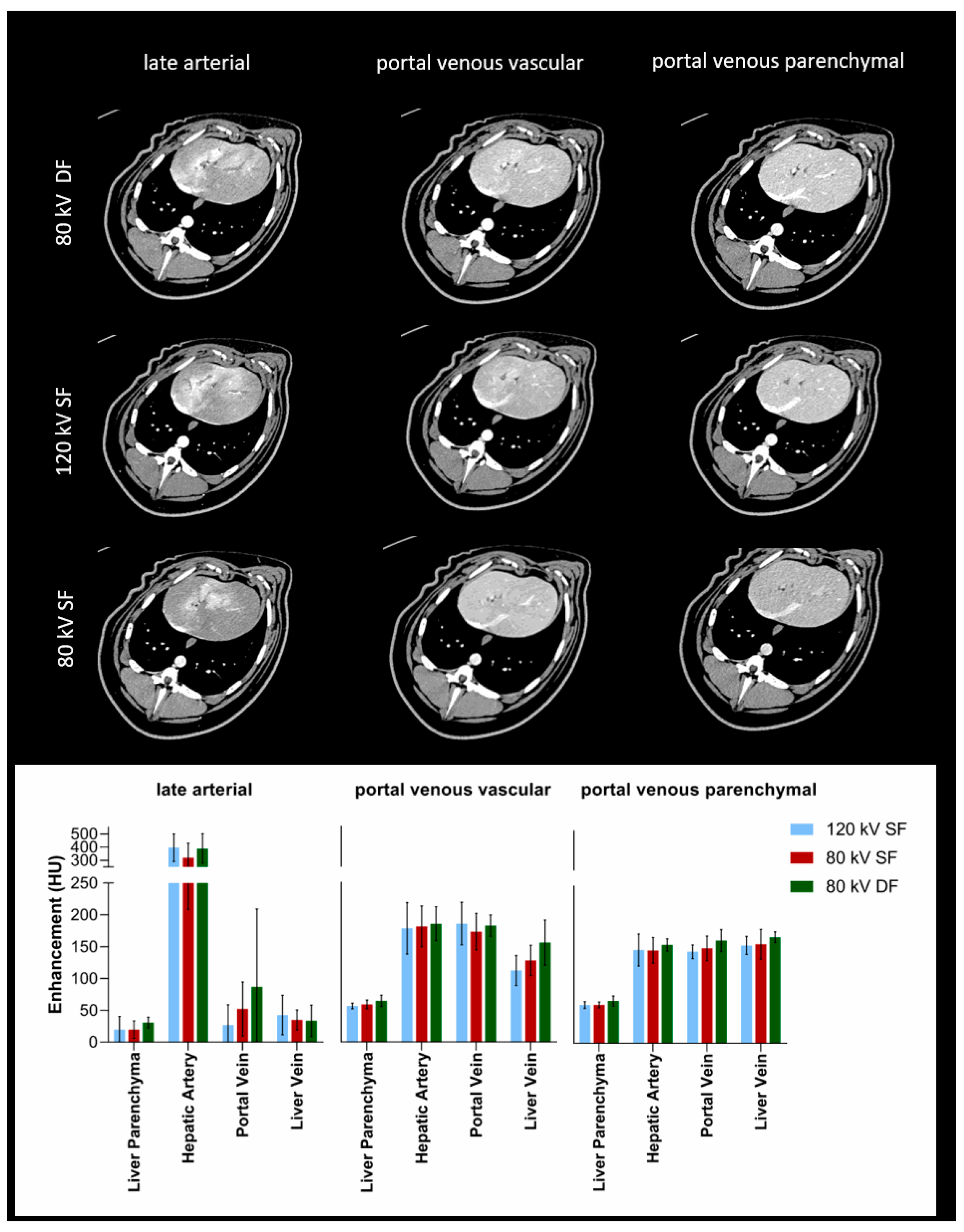 Tomography 07 00069 g004