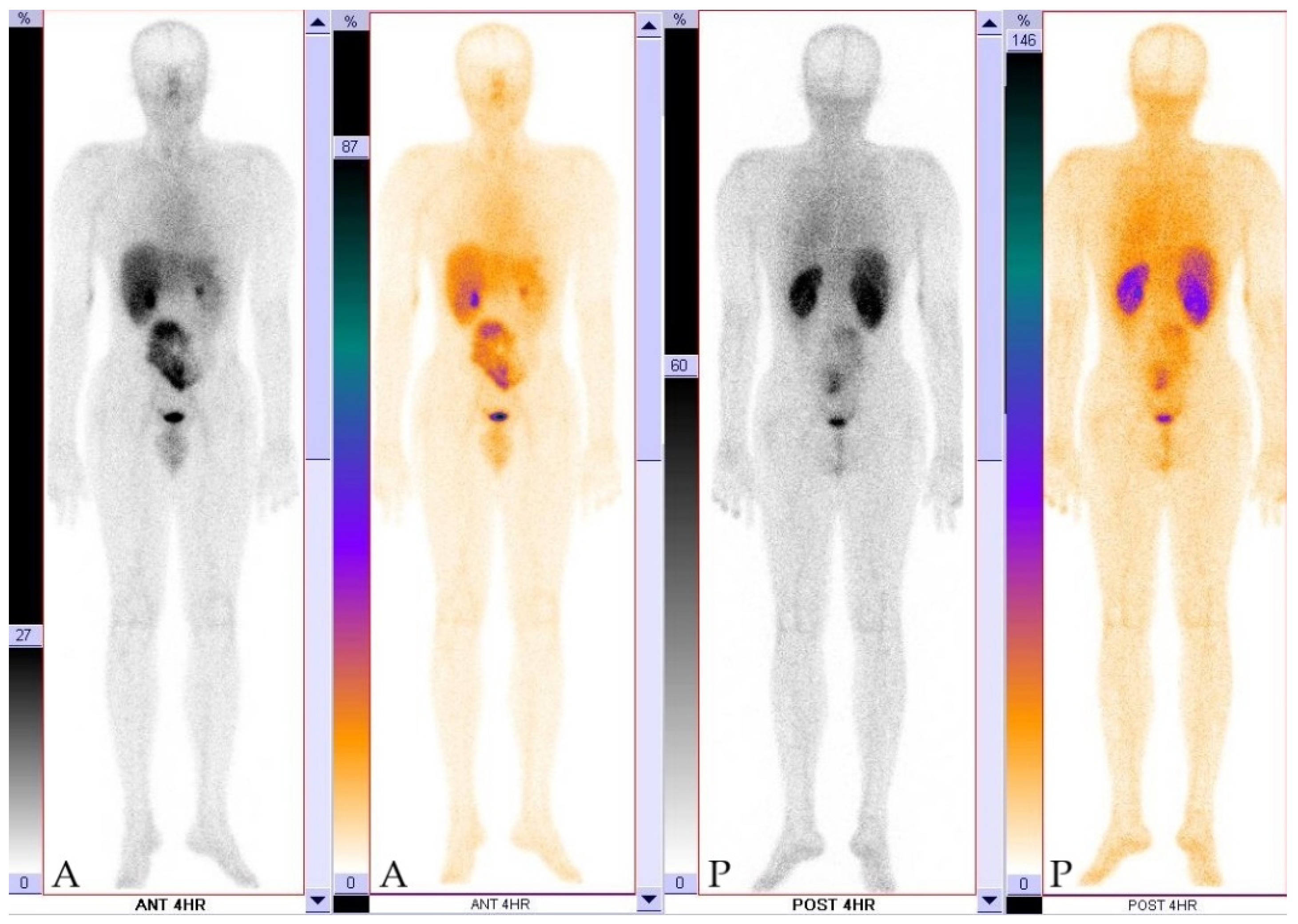 Tomography 07 00070 g007