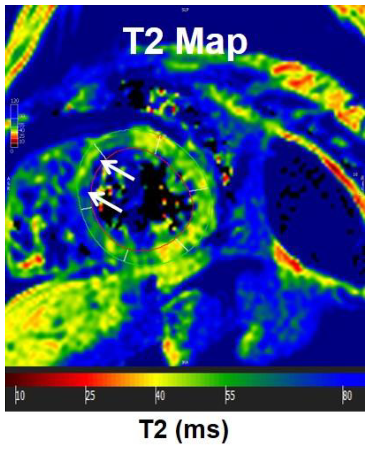 Tomography 07 00075 g010