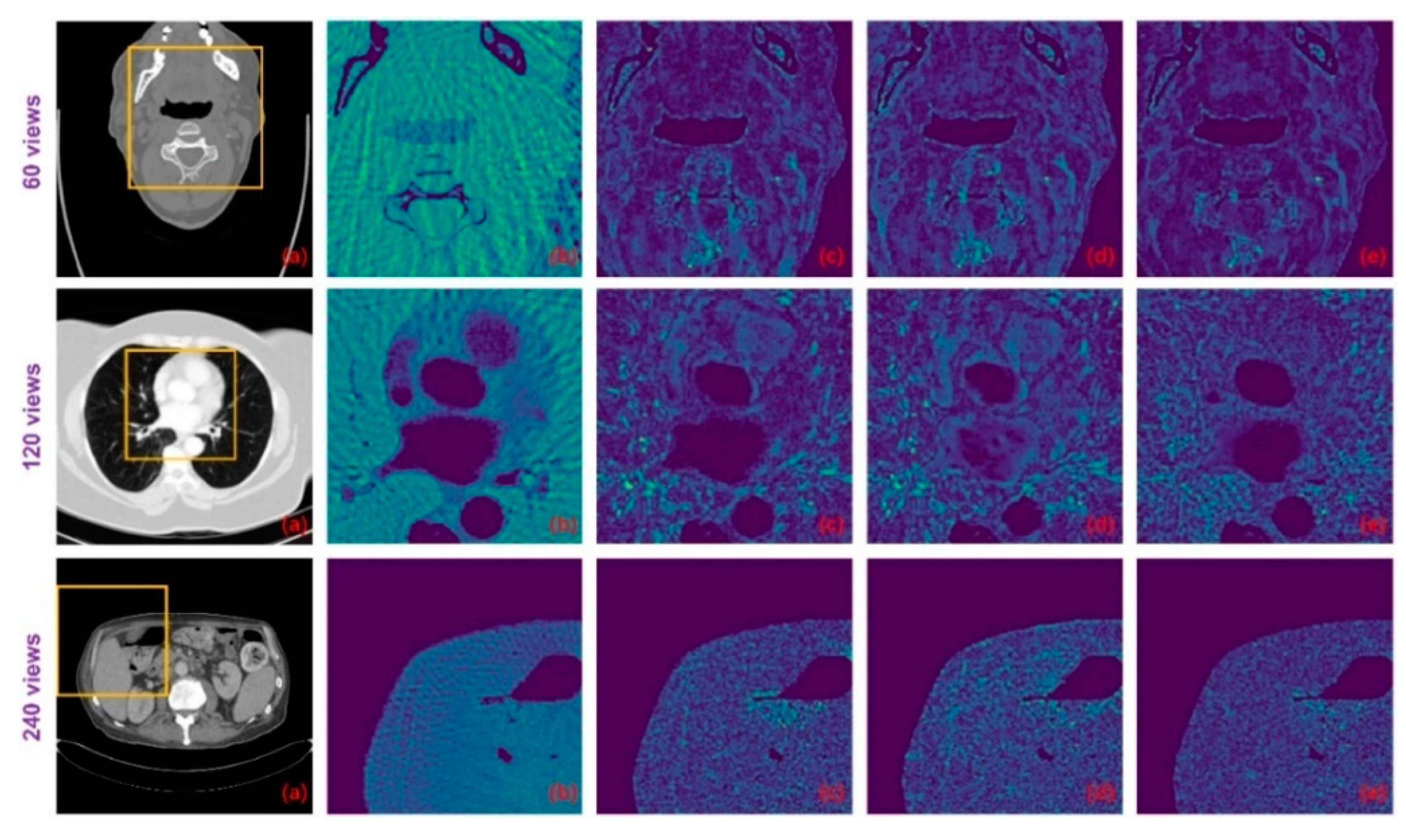 Tomography 07 00077 g009