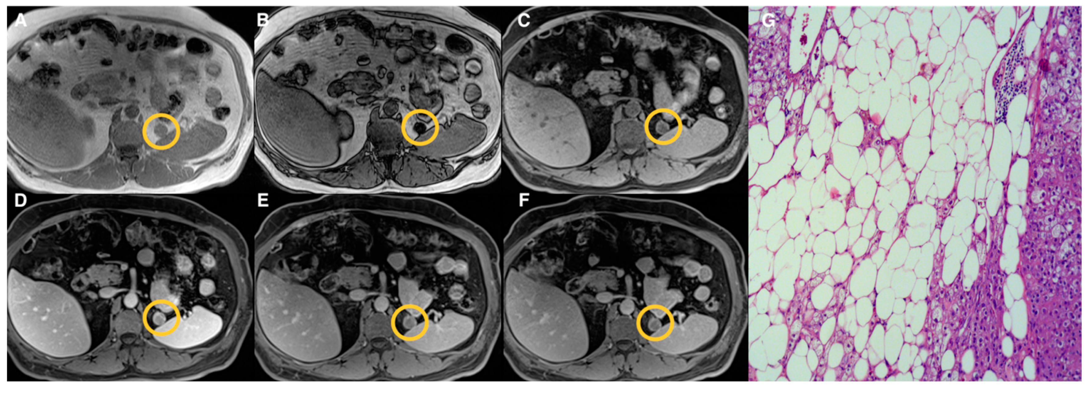 Tomography 07 00079 g002
