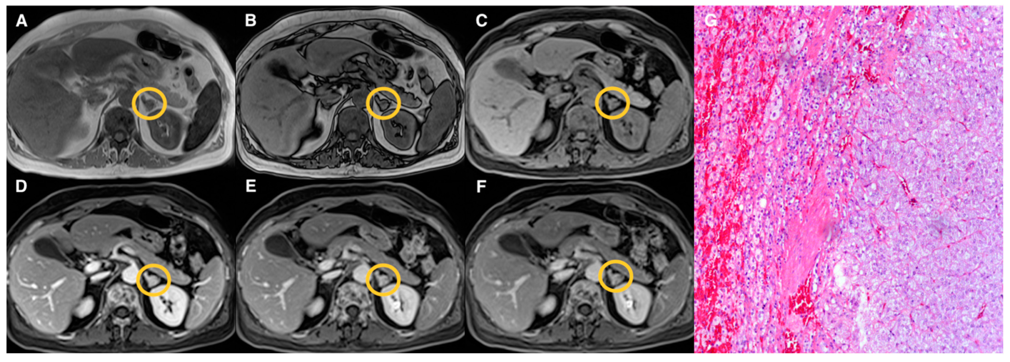 Tomography 07 00079 g004