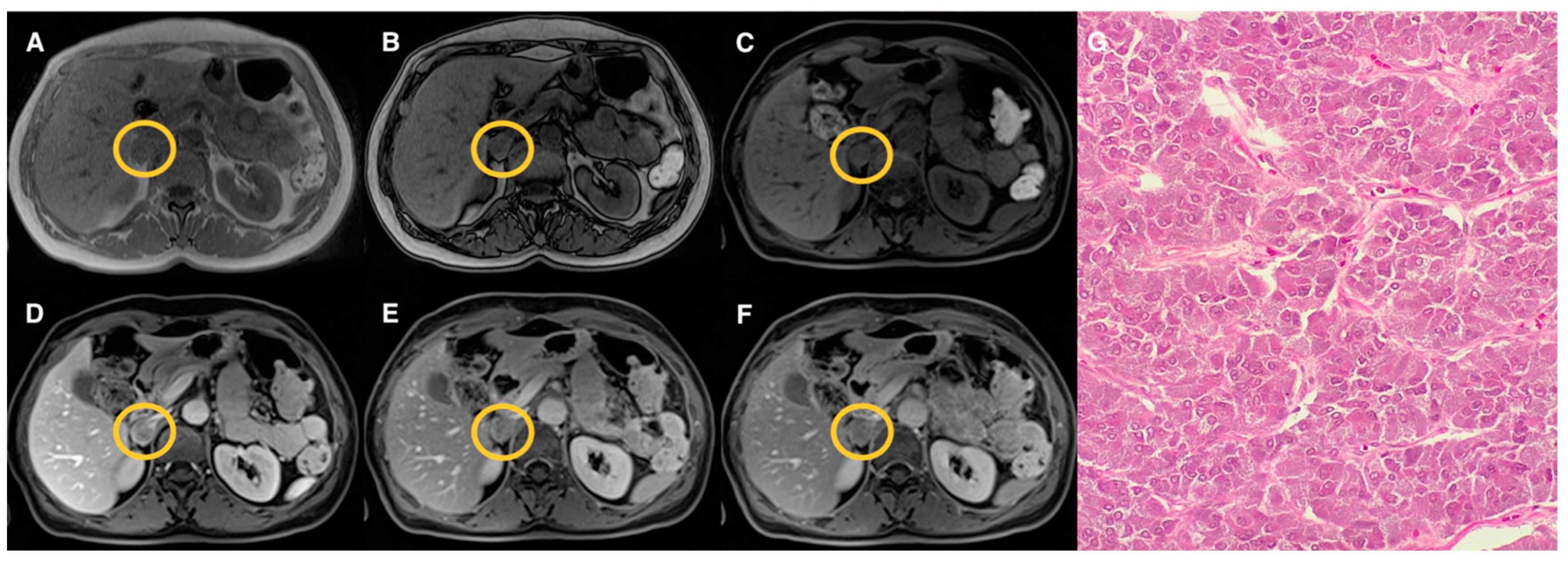 Tomography 07 00079 g005