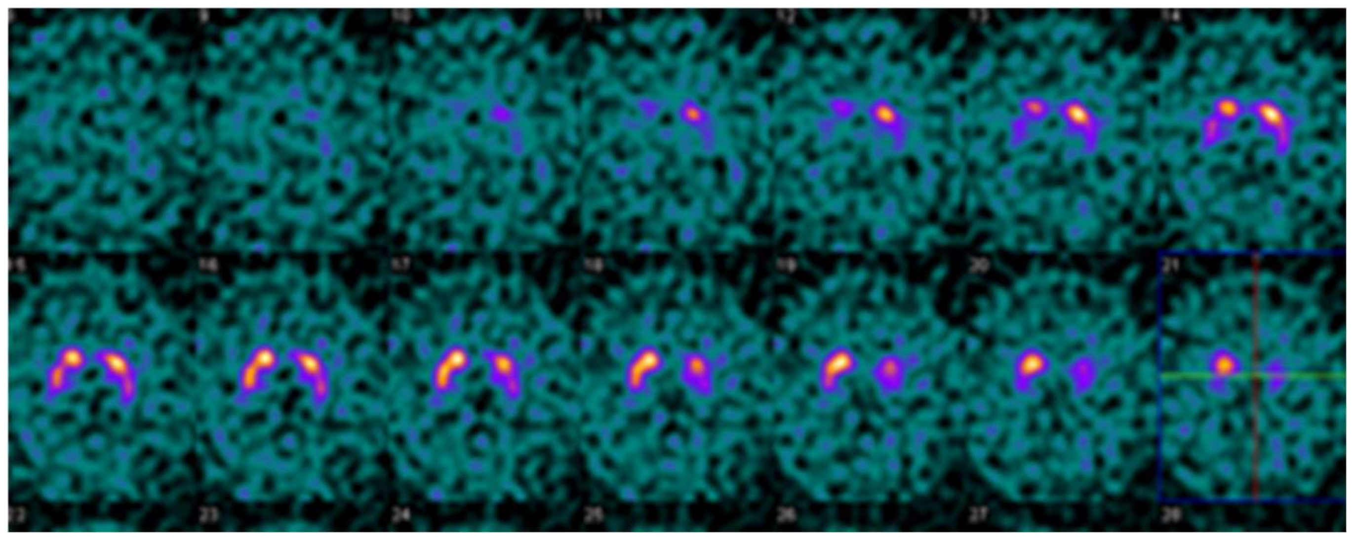 Tomography 07 00081 g003