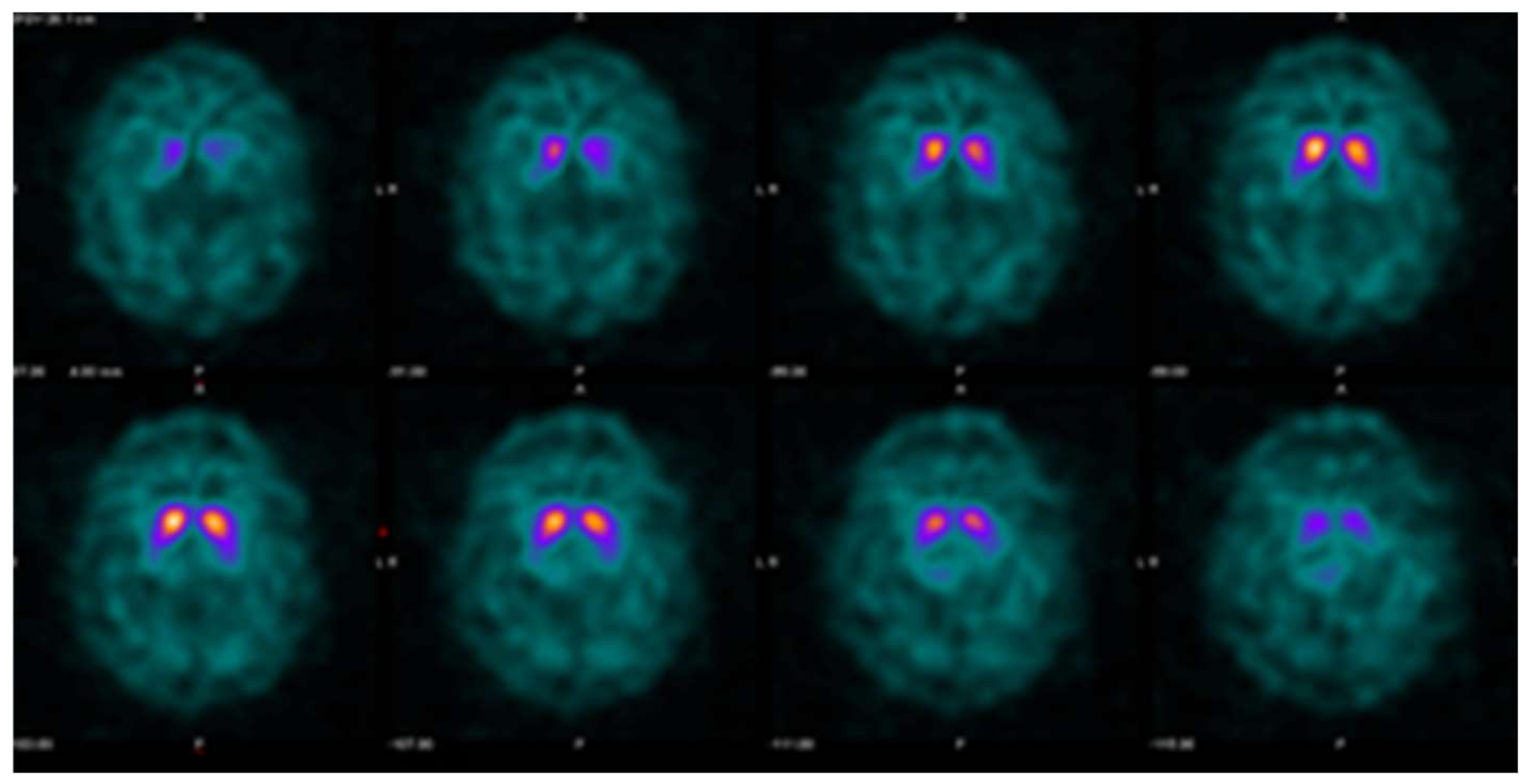 Tomography 07 00081 g004