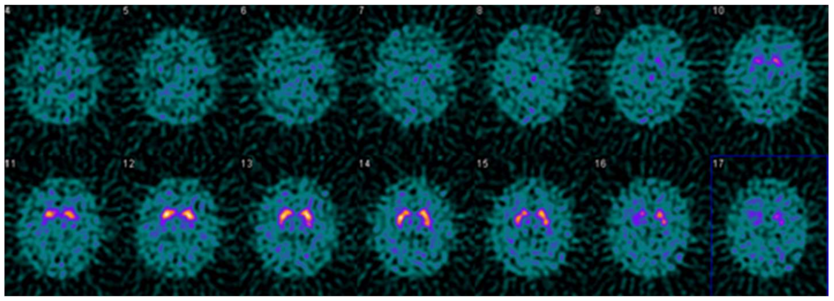 Tomography 07 00081 g005