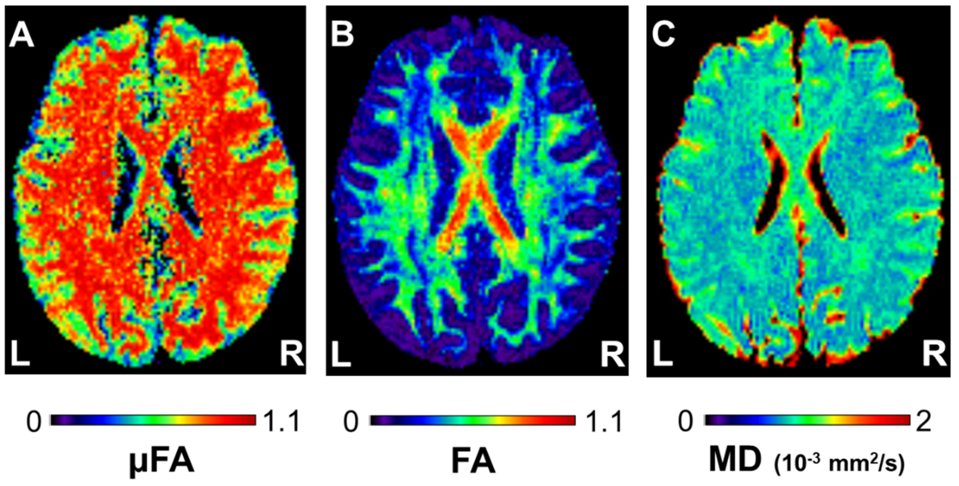 Tomography 08 00004 g002
