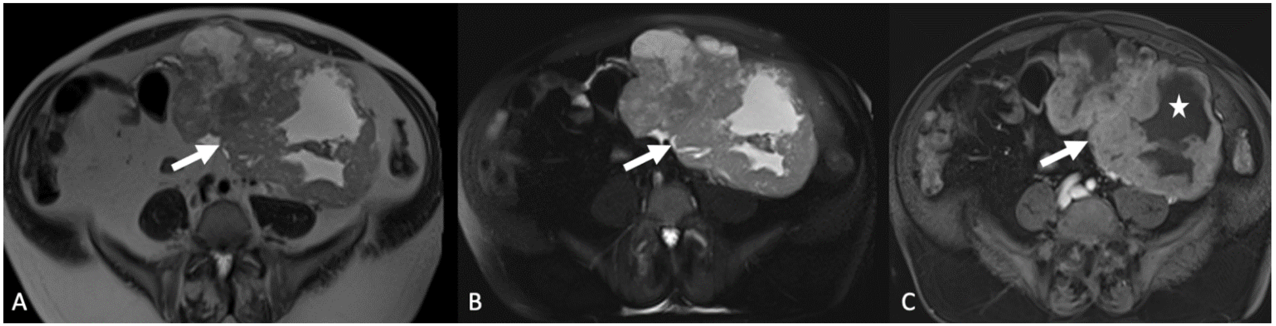 Tomography 08 00009 g013 Tomography 08 00009 g013