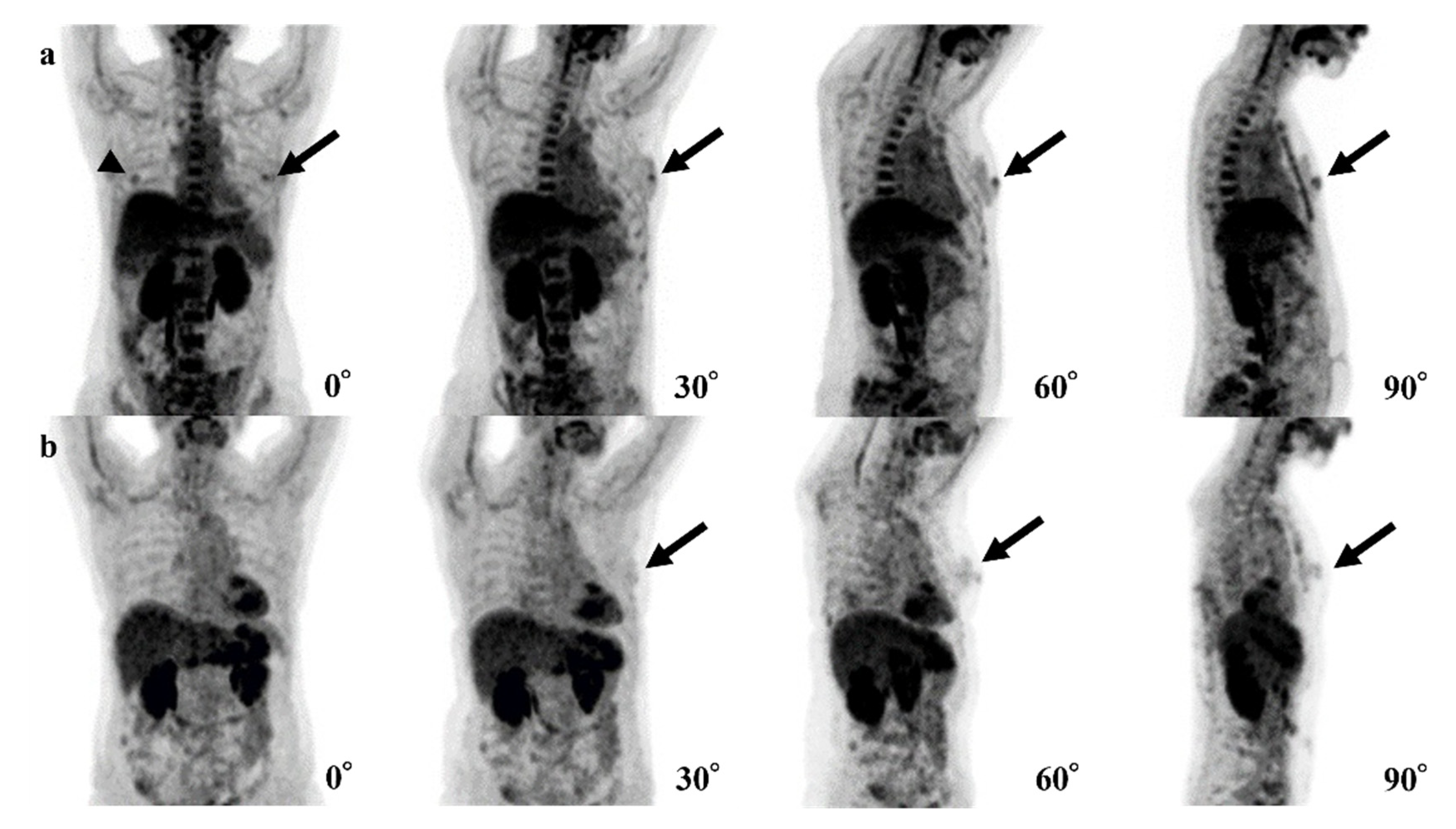 Tomography 08 00011 g003